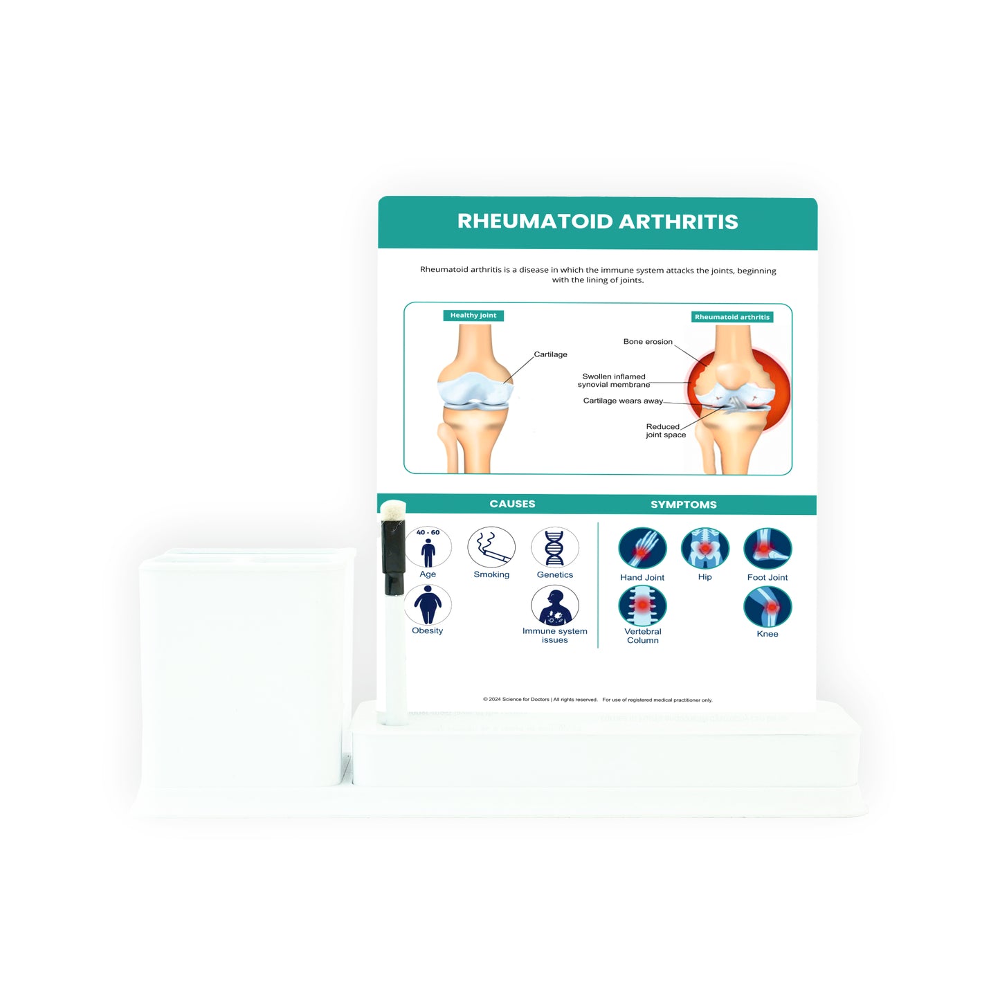 Rheumatoid Arthritis: 1 Slides Write & Wipe with Stationary Stand