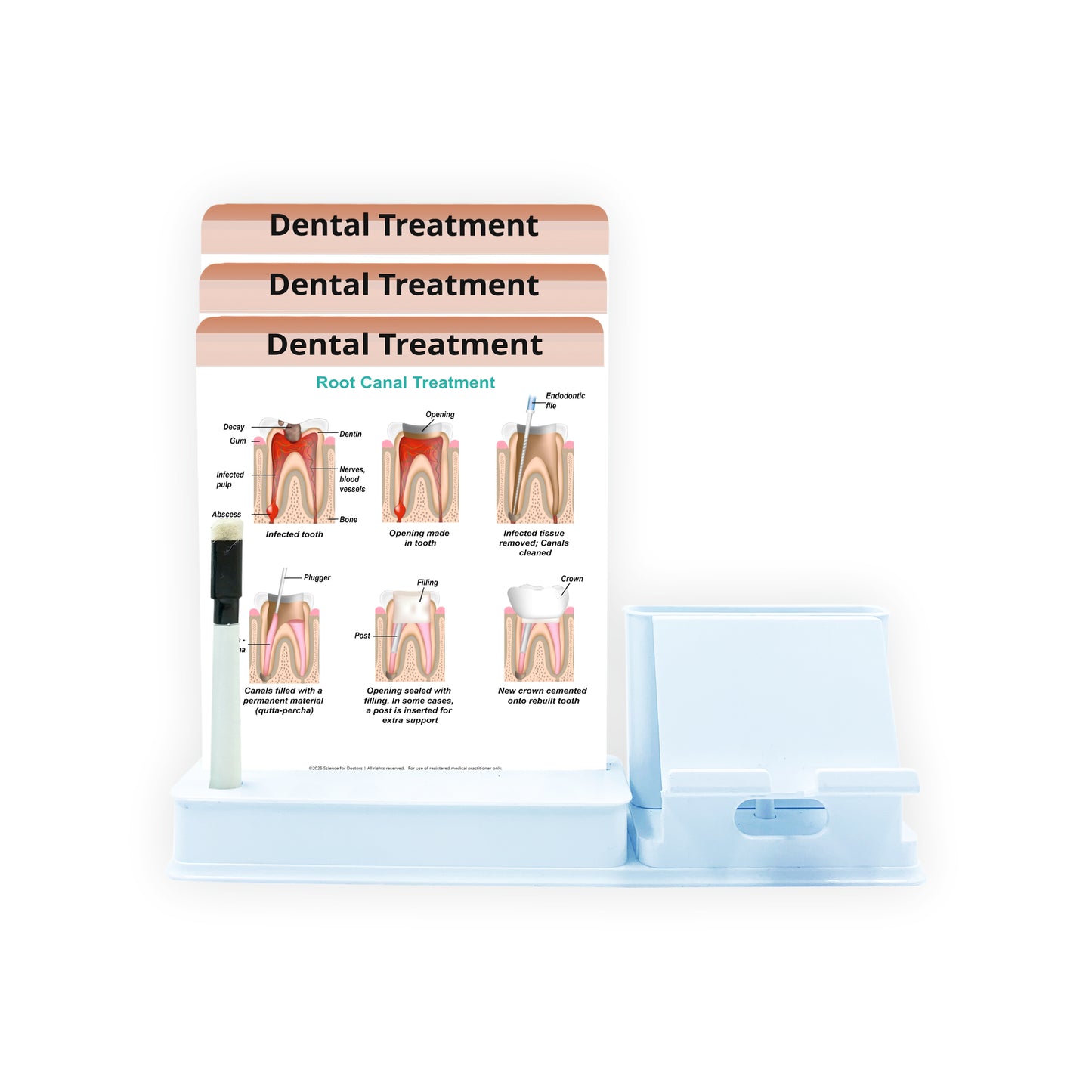 Smart - 3 Slides Write & Wipe With Mobile and Chit pad Stand - Dental Treatment