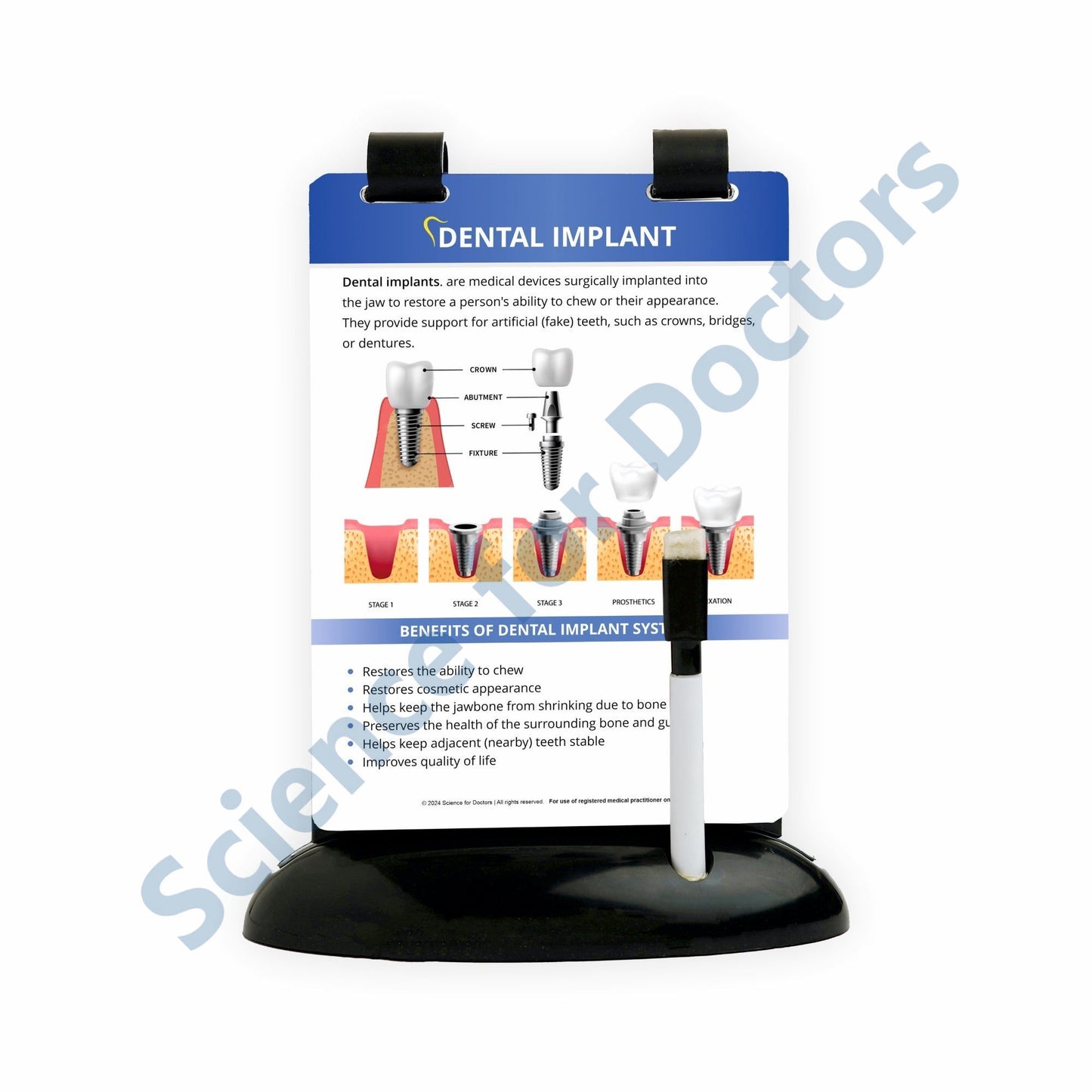 Dental Implant: A5 Flip Wipe