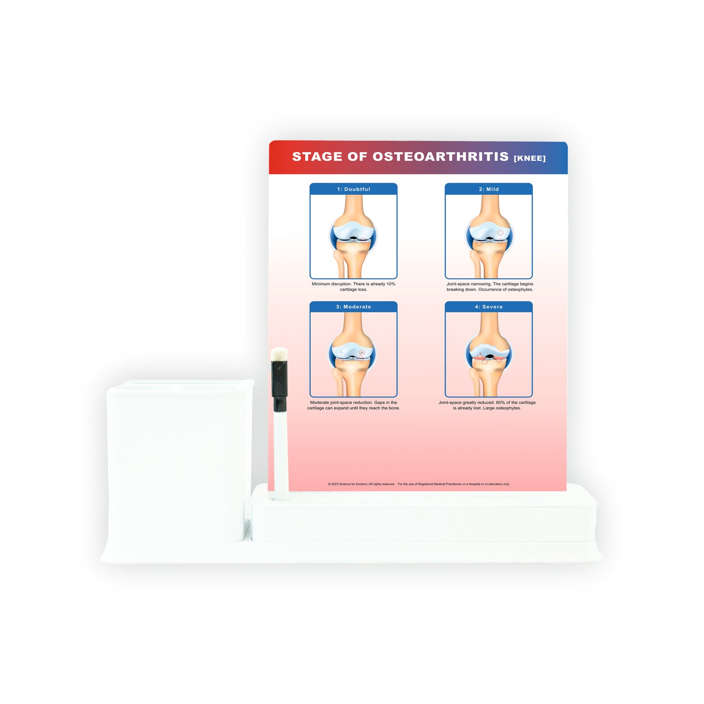 STAGE OF OSTEOARTHRITIS: 1 Slides Write & Wipe with Stationary Stand