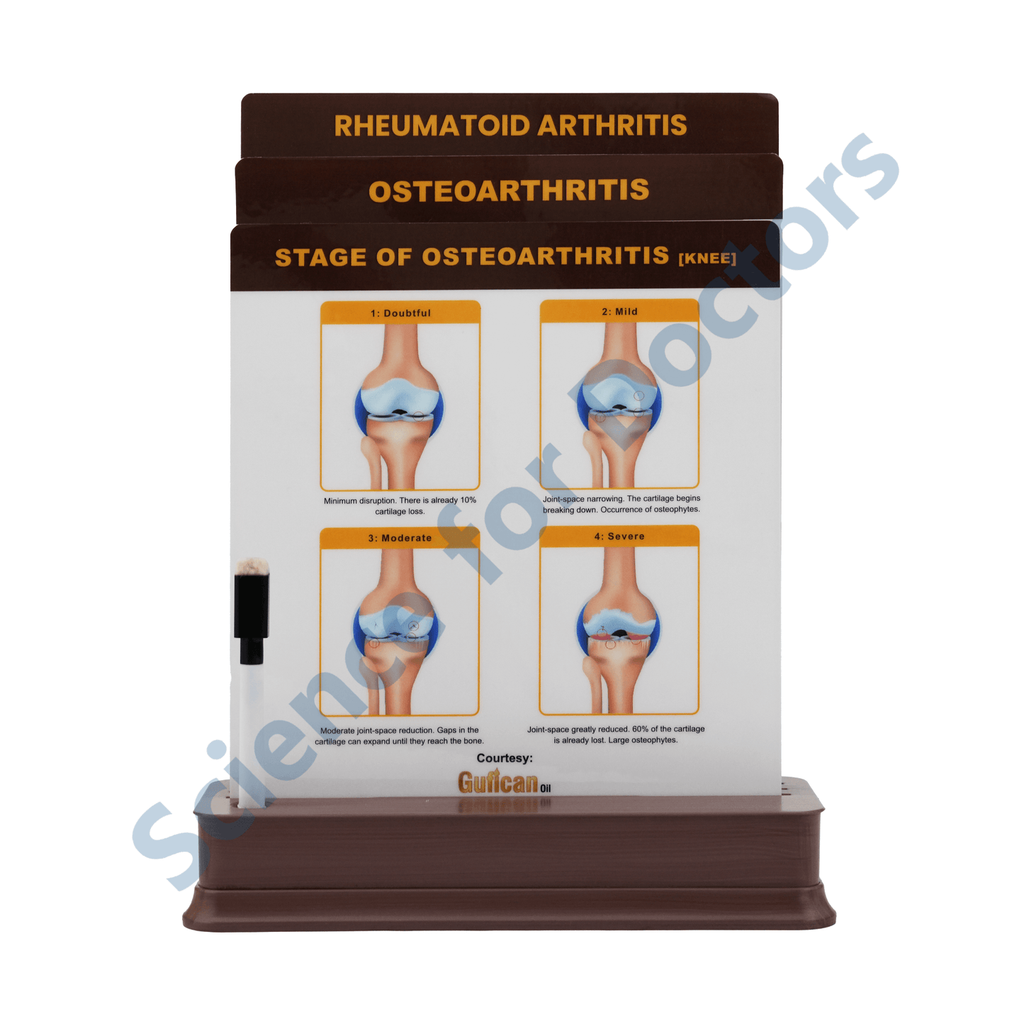 Osteoarthritis: 3 slide on stand