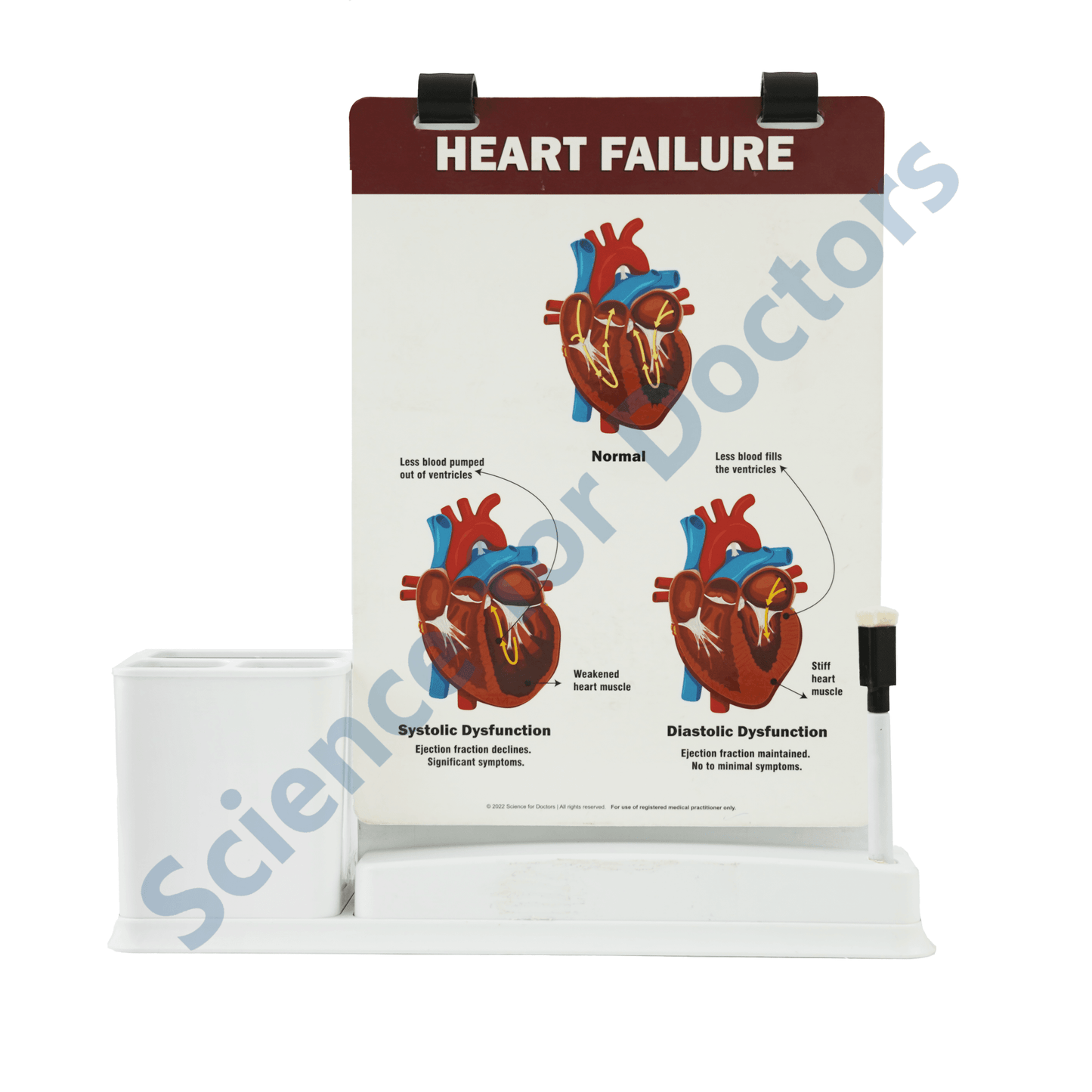 Heart Failure: A4 Flip Wipe With Stationary Stand