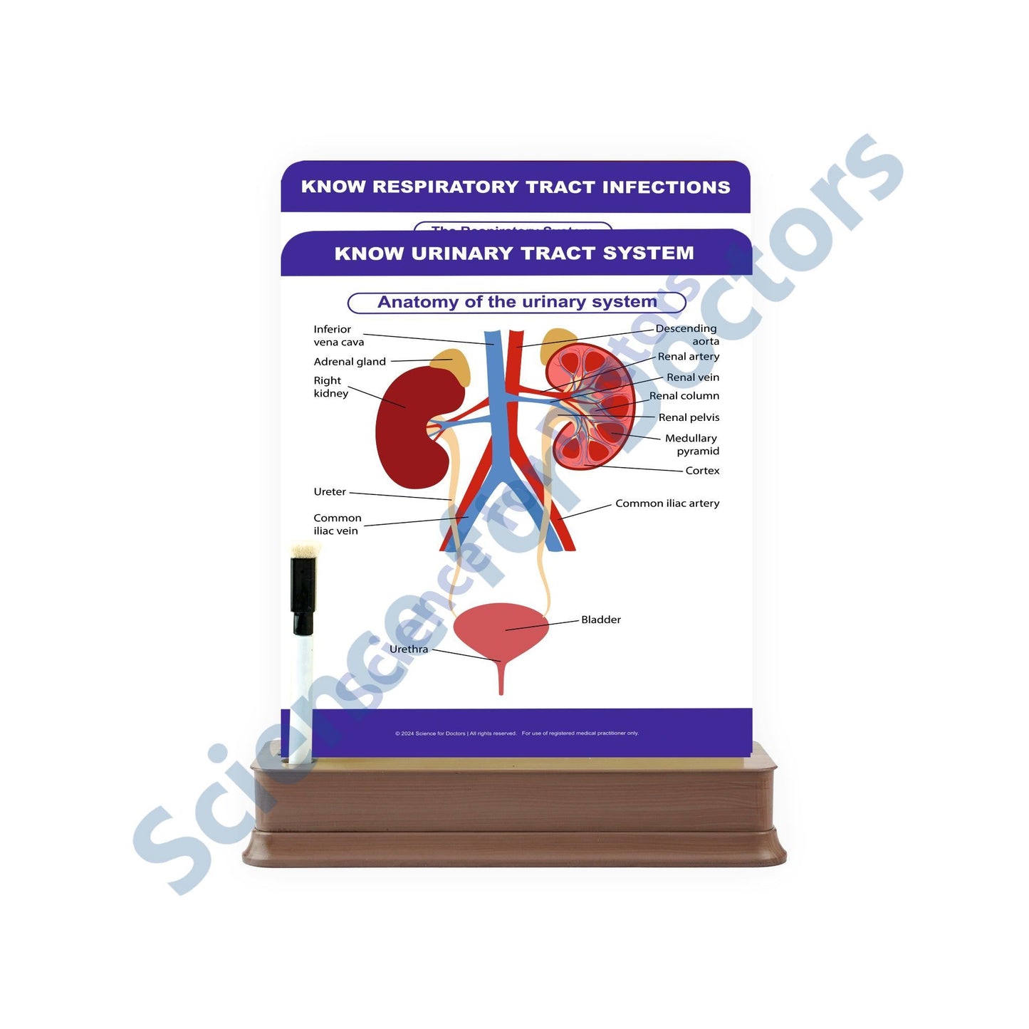 Know Urinary Tract System: 2 Slides on stand