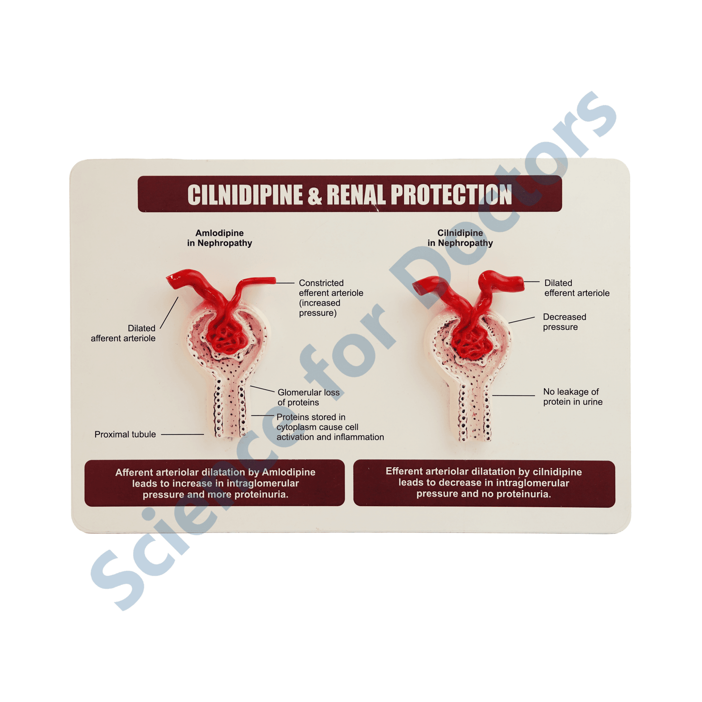 Cilnidipine & Renal Protection: 3d therapy Board