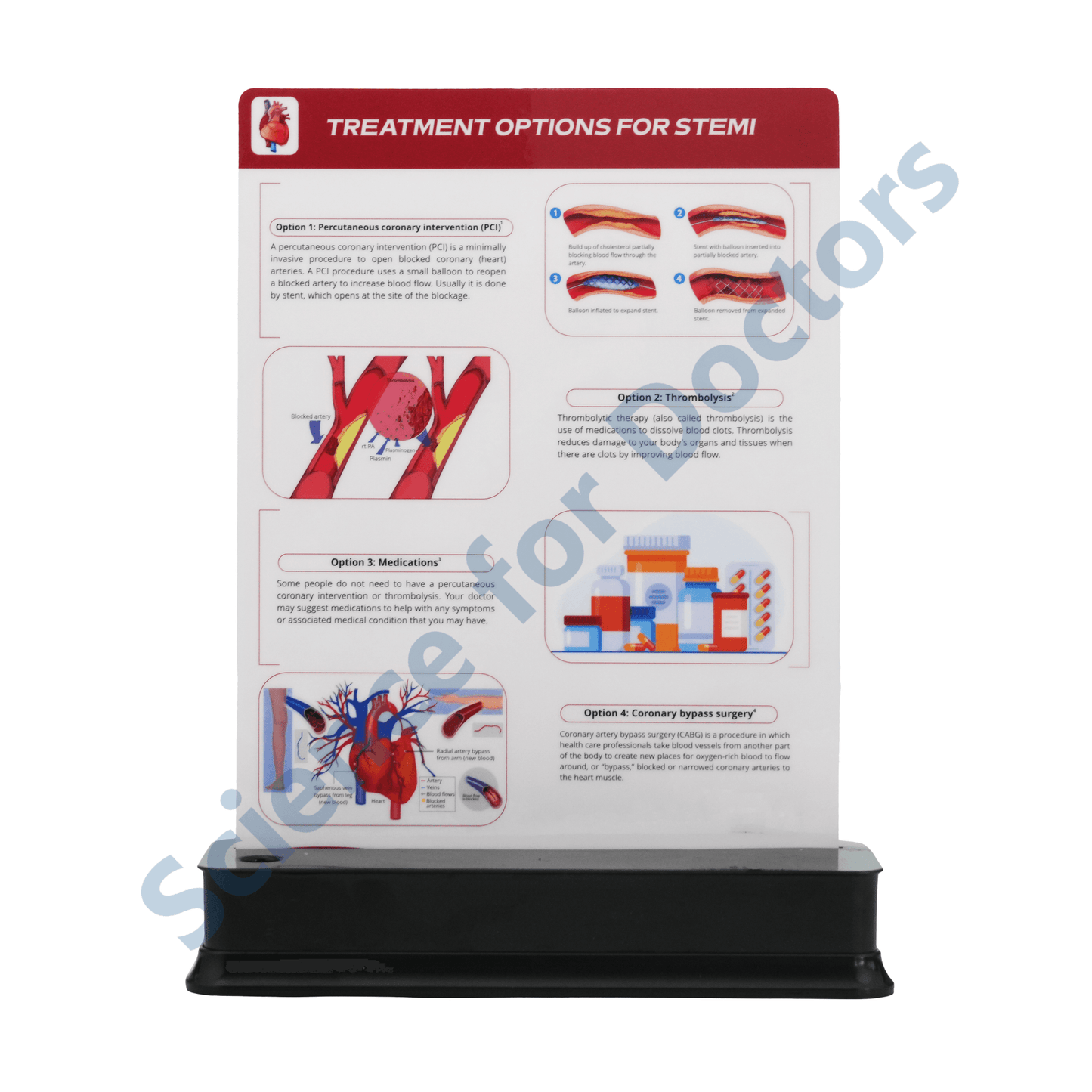 Treatment Options For STEMI: 1 Slide on stand