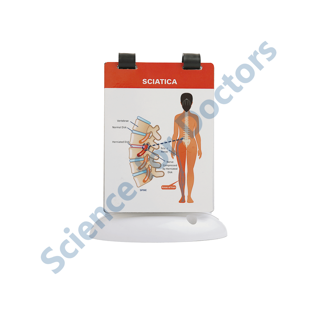 Sciatica: A5 Flip Wipe