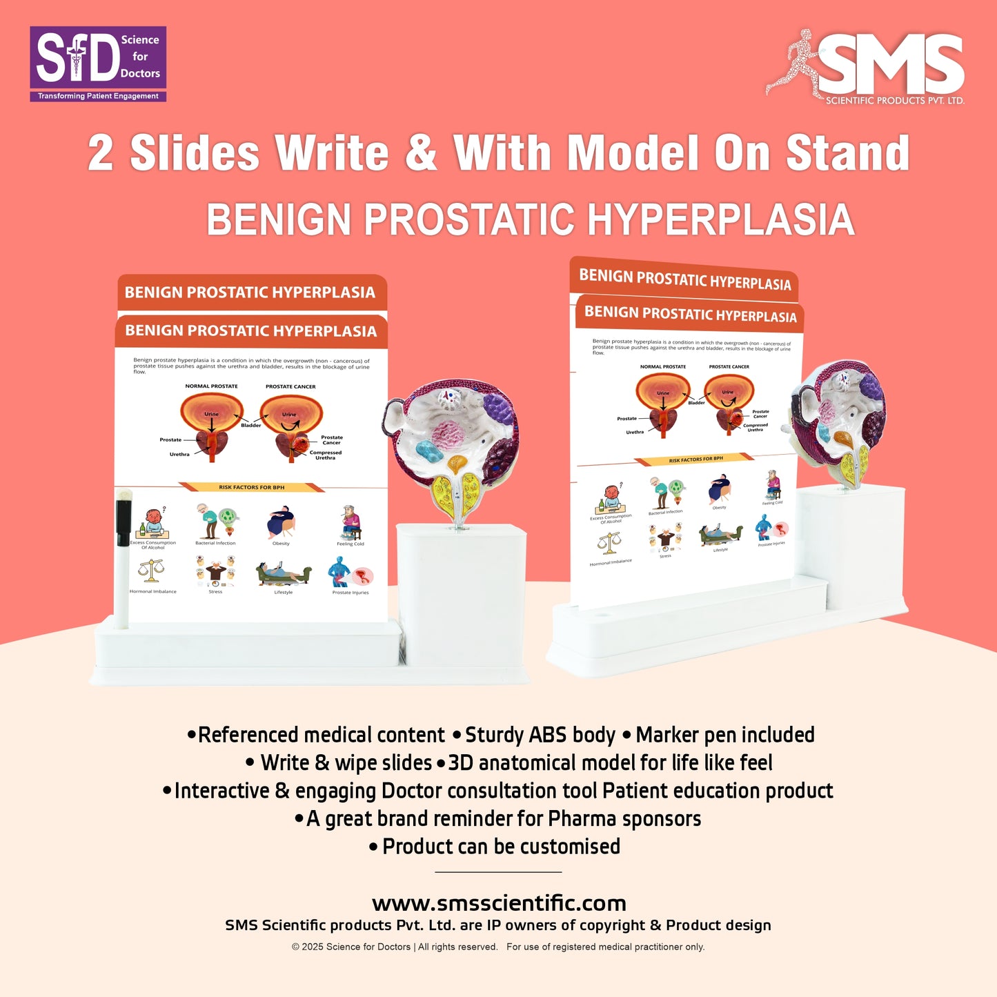 Benign Prostatic Hyperplasia : 2 Slides Write and Wipe with Model On Stand