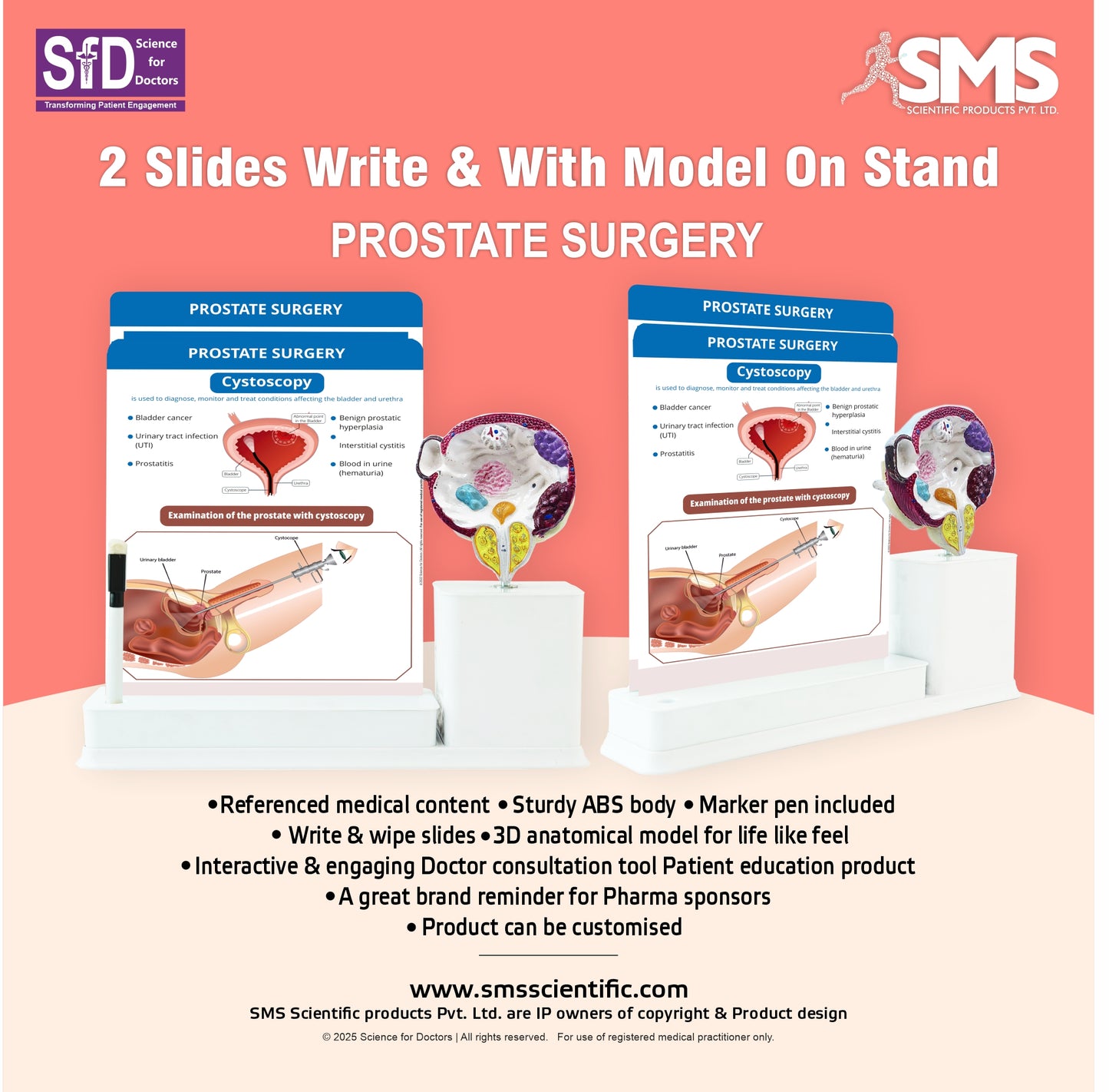 Prostate Surgery: 2 Slides Write and Wipe with Model On Stand
