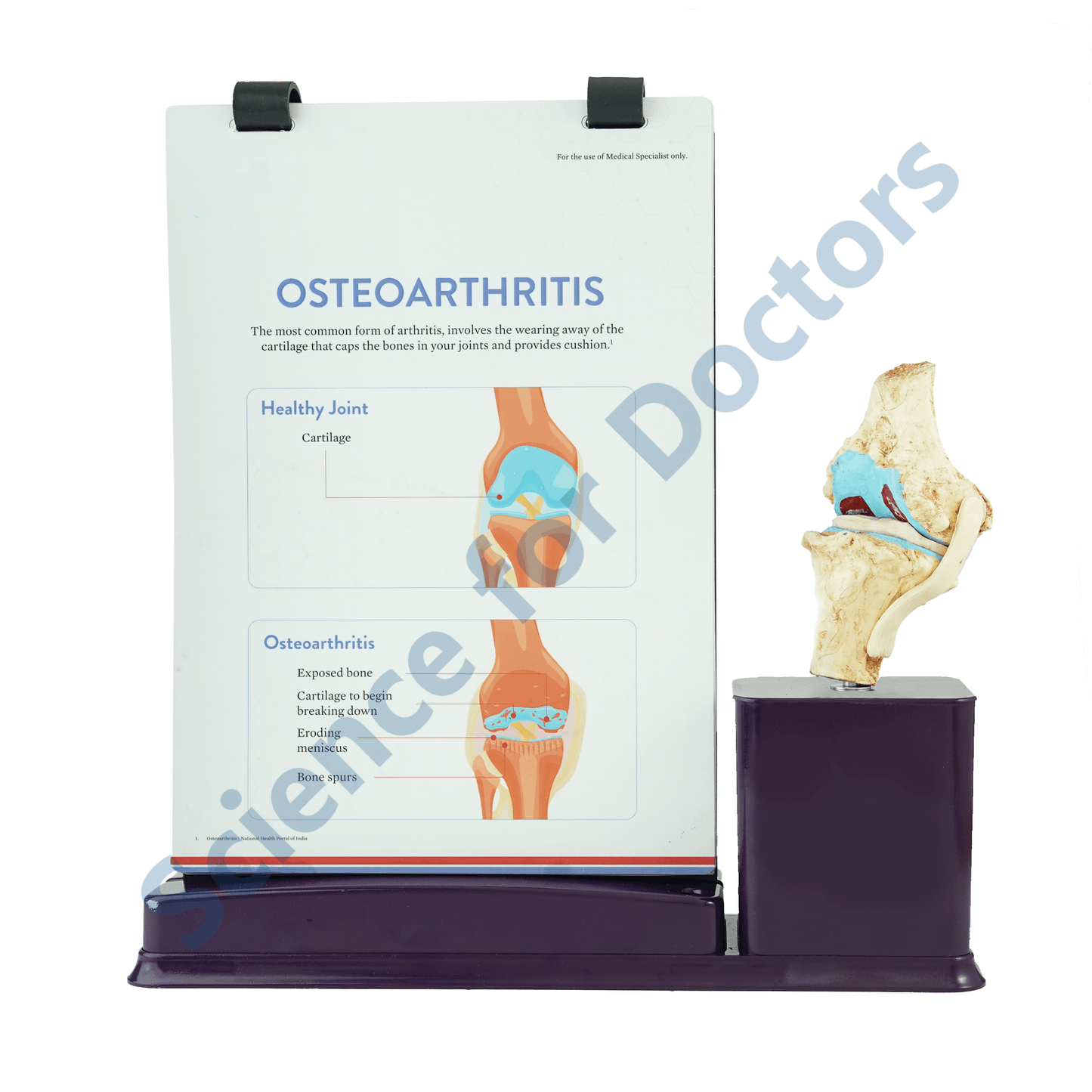 Osteoarthritis: A4 Flip Wipe With Anatomical Model