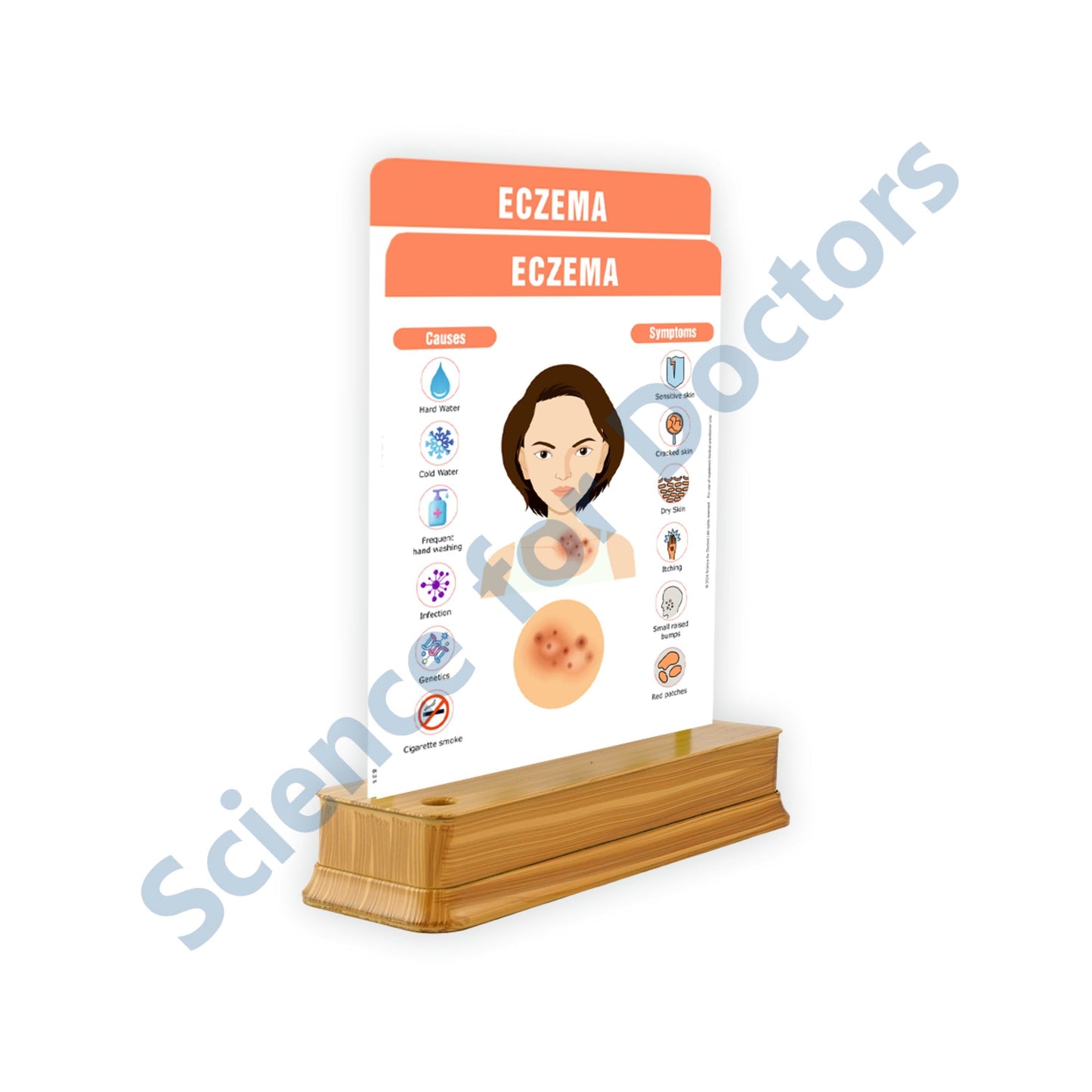 Eczema: 2 Slides on stand