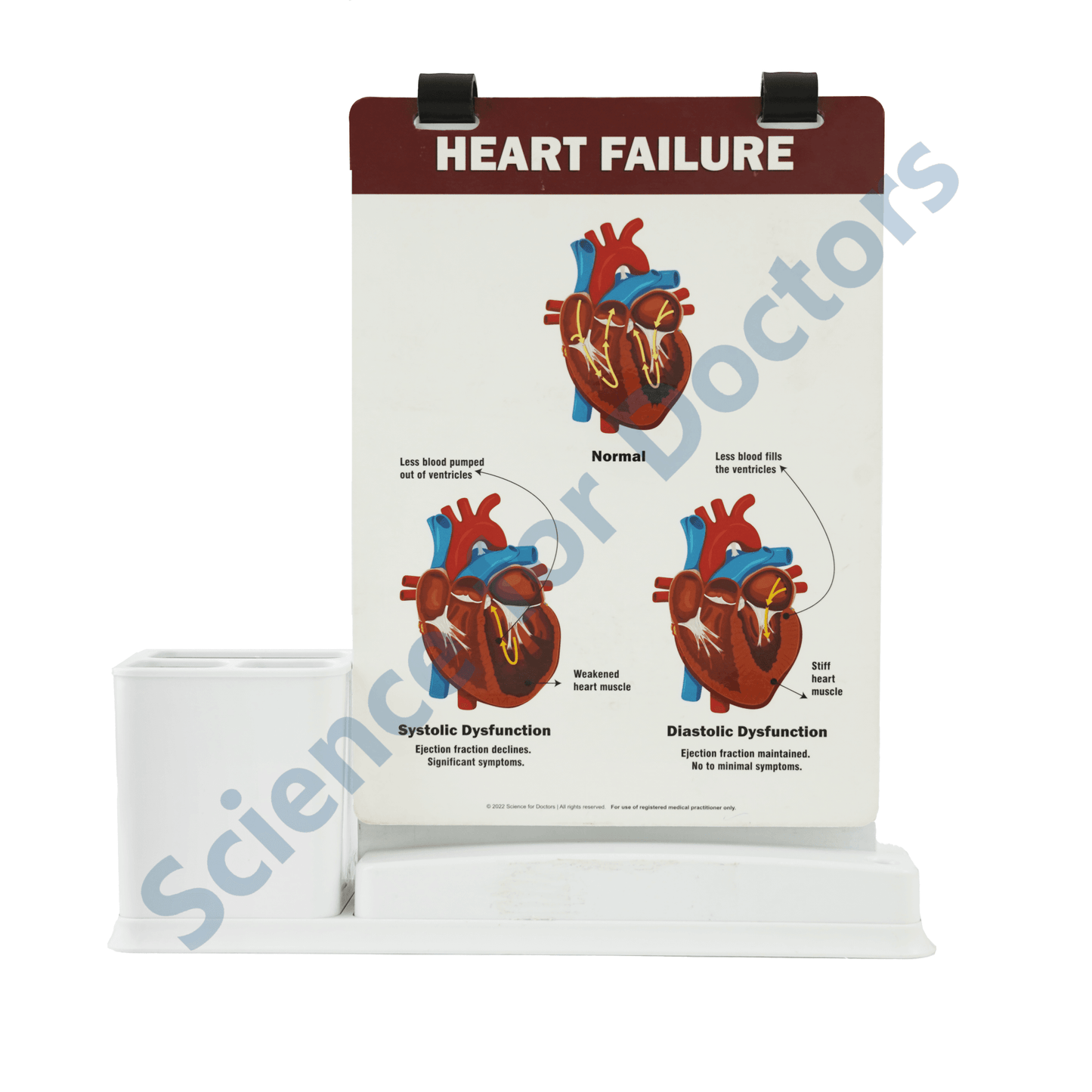 Heart Failure: A4 Flip Wipe With Stationary Stand