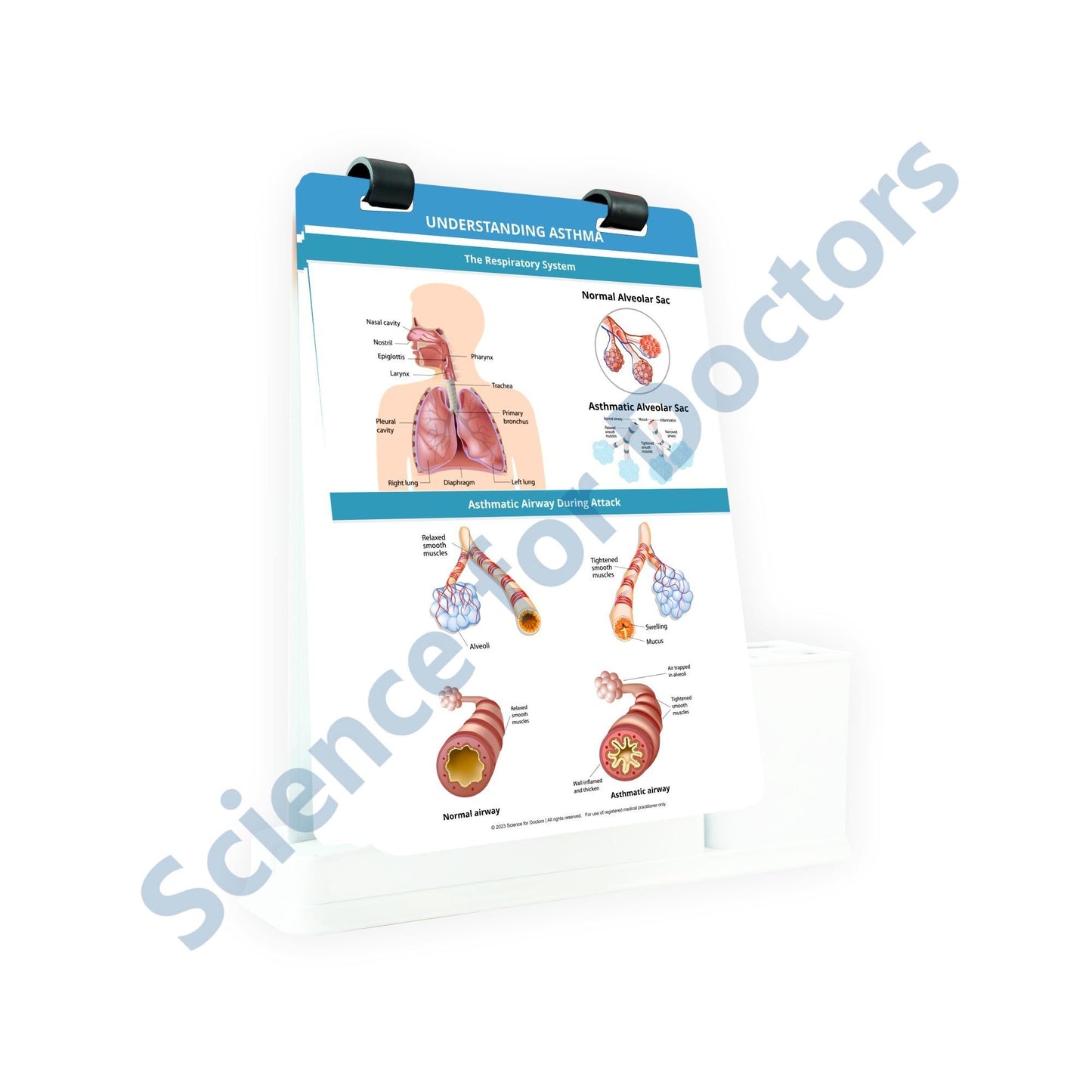 Understanding Asthma: A4 Flip Wipe With Stationary Stand