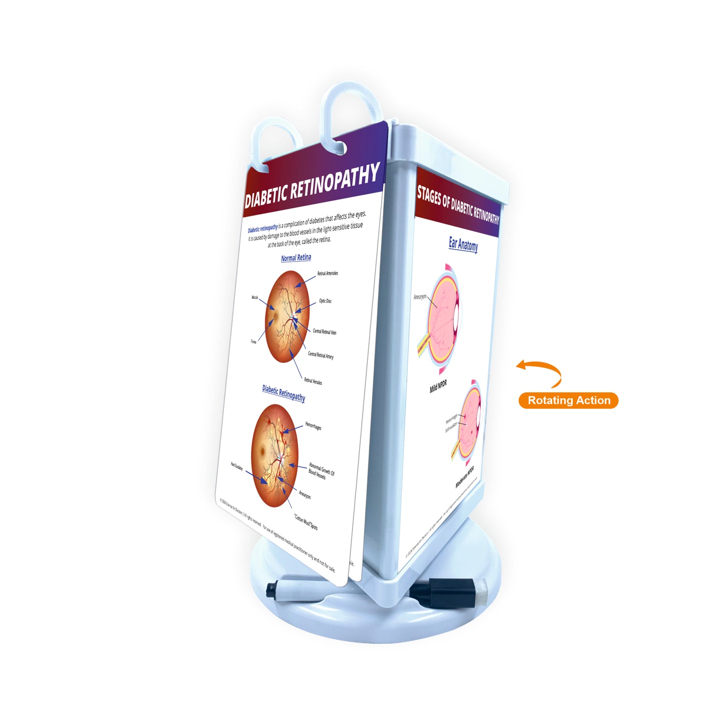 ROTRI - V WITH FLIP WIPES ON TOP  -  DIABETIC RETINOPATHY
