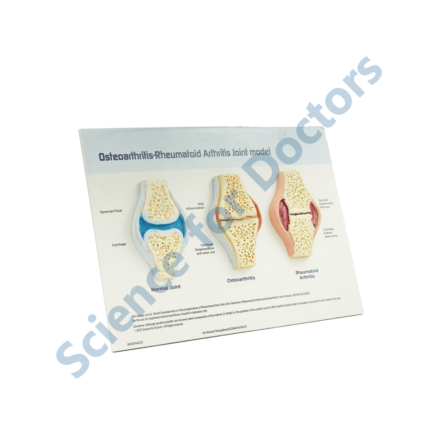 Osteoarthritis: 3d therapy Board