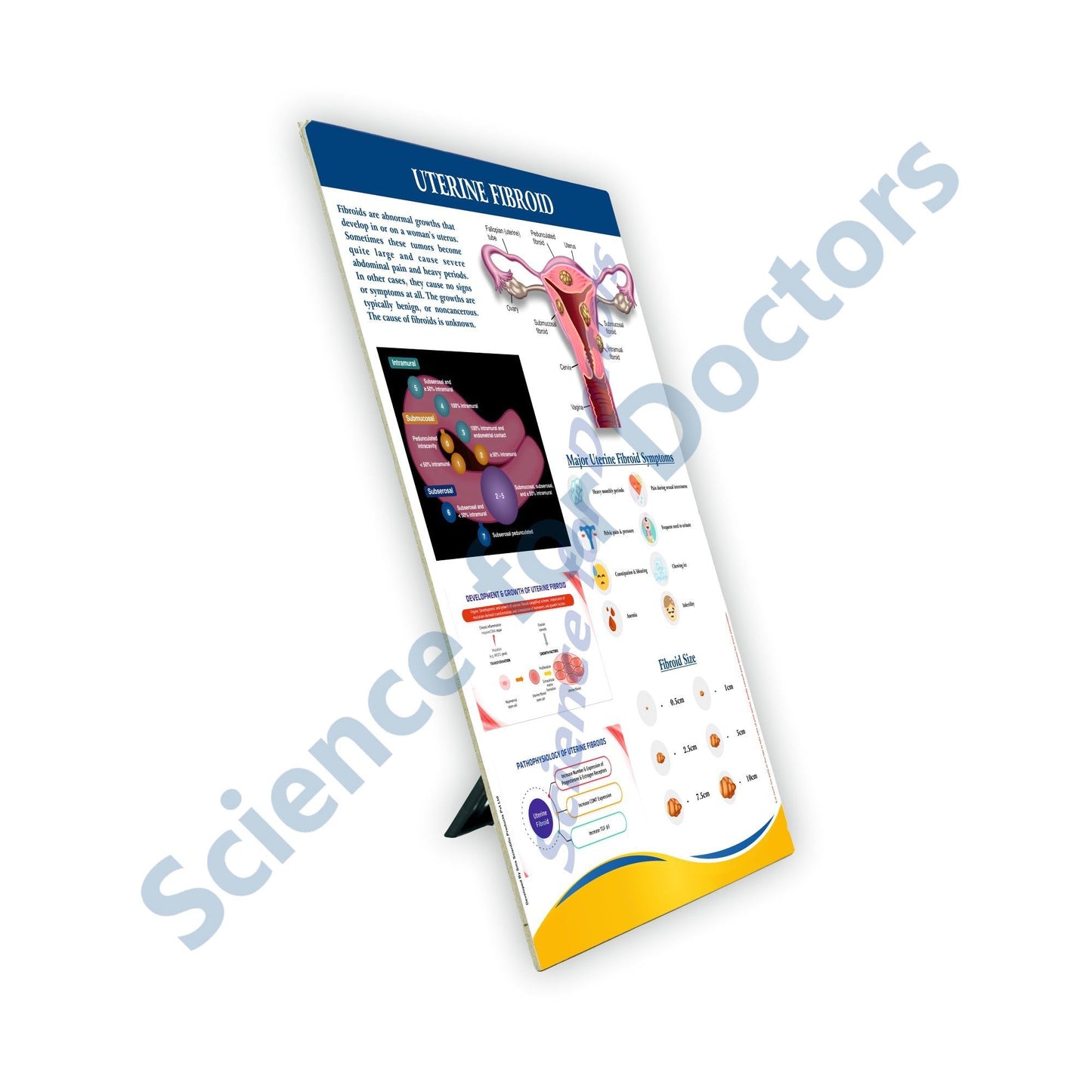 Uterine Fibroid: Therapy Board