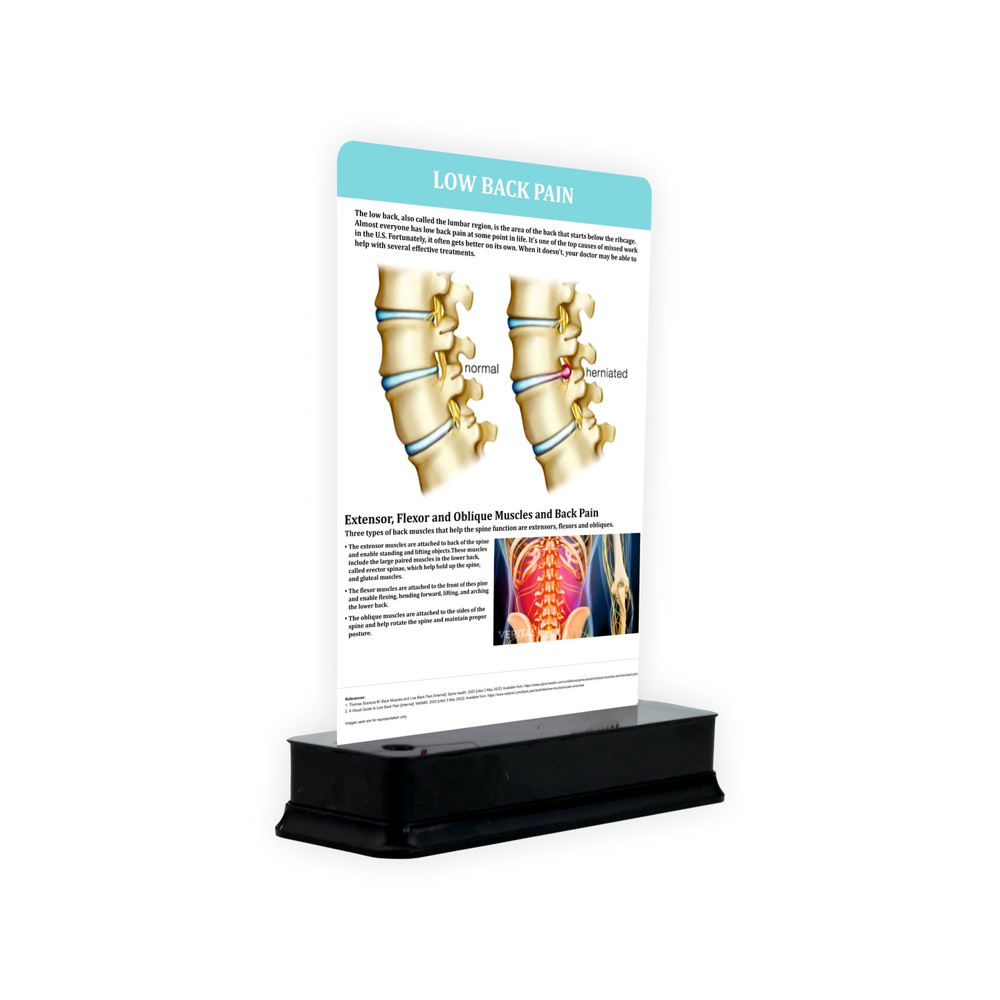 Low Back Pain: 1 Slide on stand