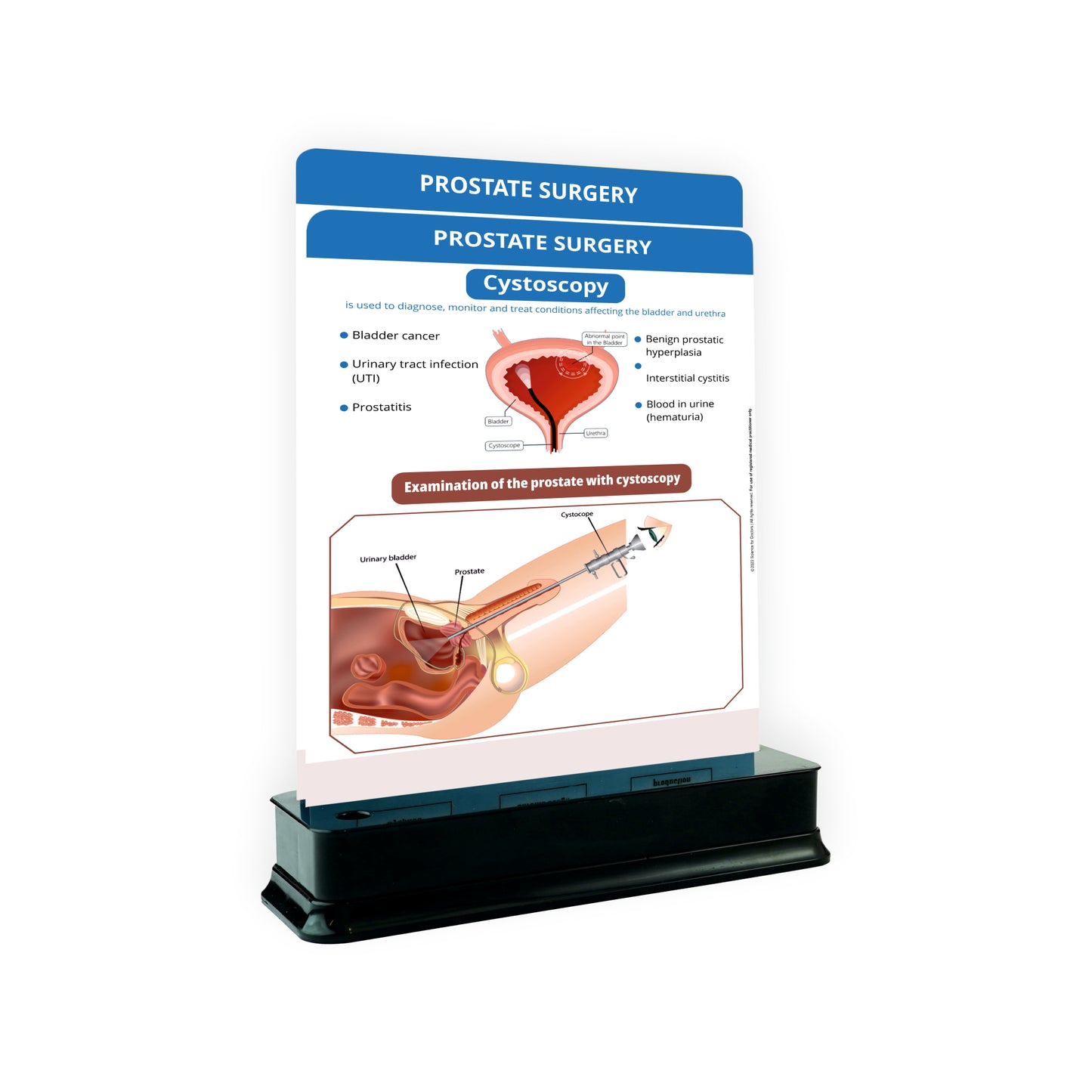 Prostate Surgery: 2 Slides With Stand