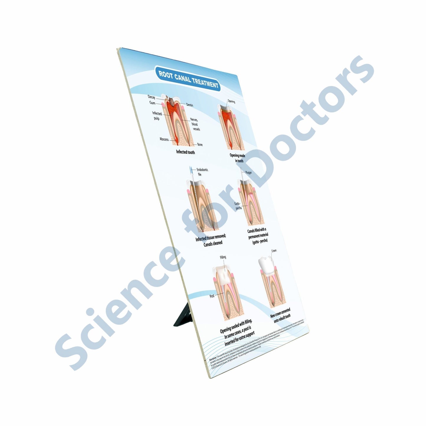 Root Canal Treatment: Therapy Board