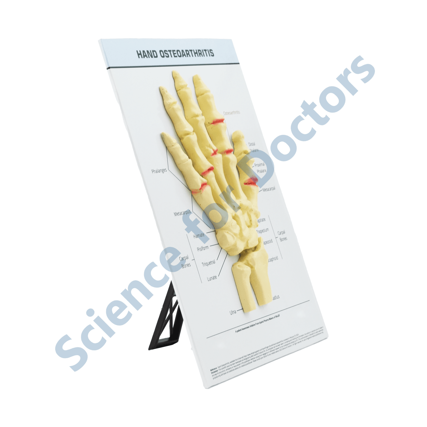 Hand Osteoarthritis: 3D therapy Board