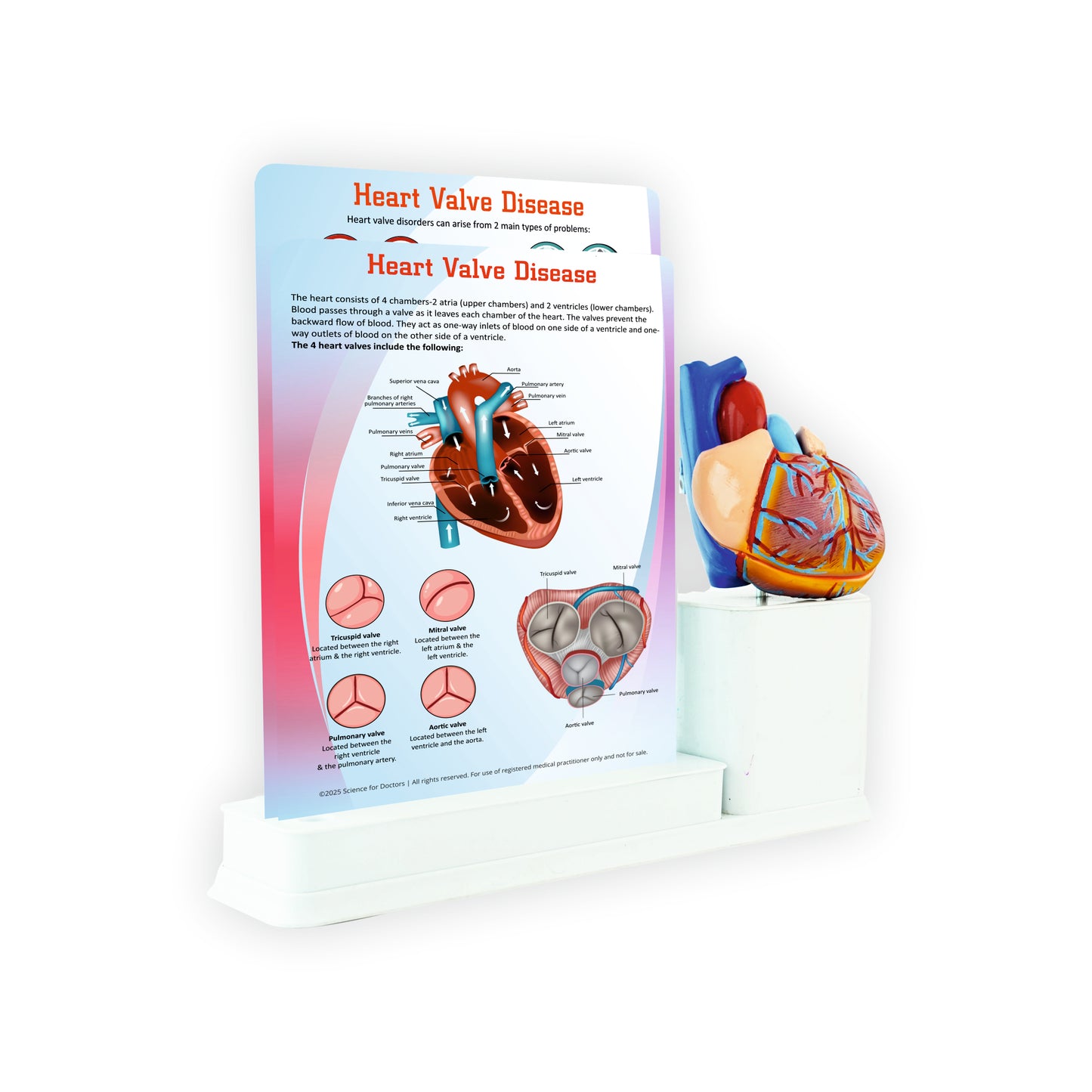 Heart Valve Disease: 2 Slides Write & Wipe with Anatomical Model on Stationary Stand