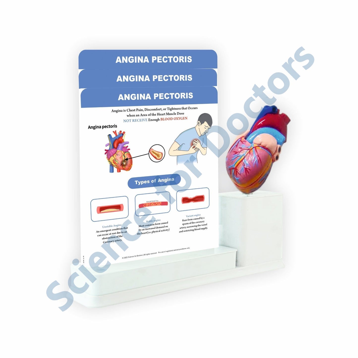 Angina Pectoris: 3 Slides Write & Wipe With Model On Stand