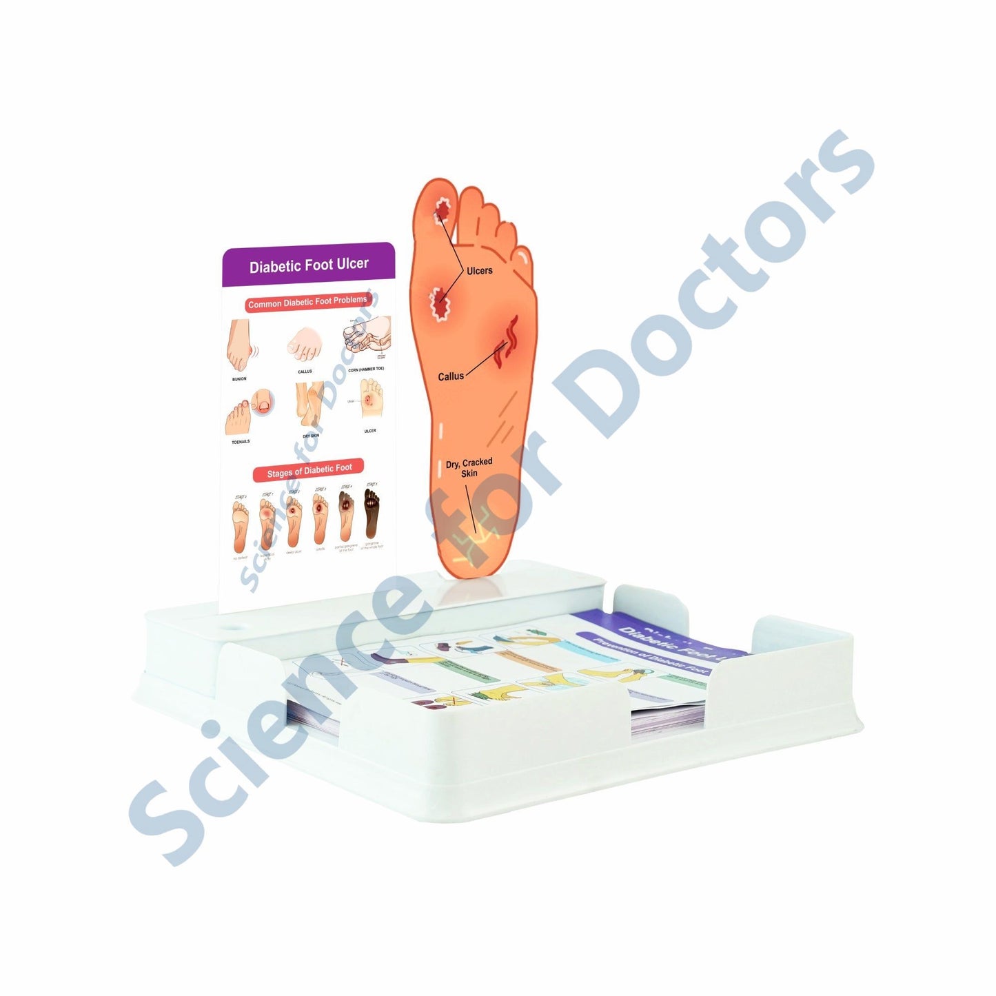 Diabetic Foot Ulcer: 1 Slide with Patient Leaflet Tray