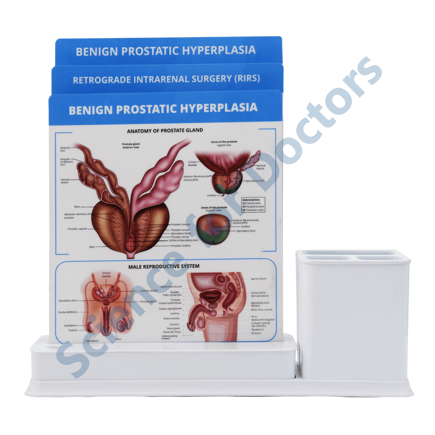 Benign Prostatic Hyperplasia: 3 Slides Write & Wipe with Stationary Stand