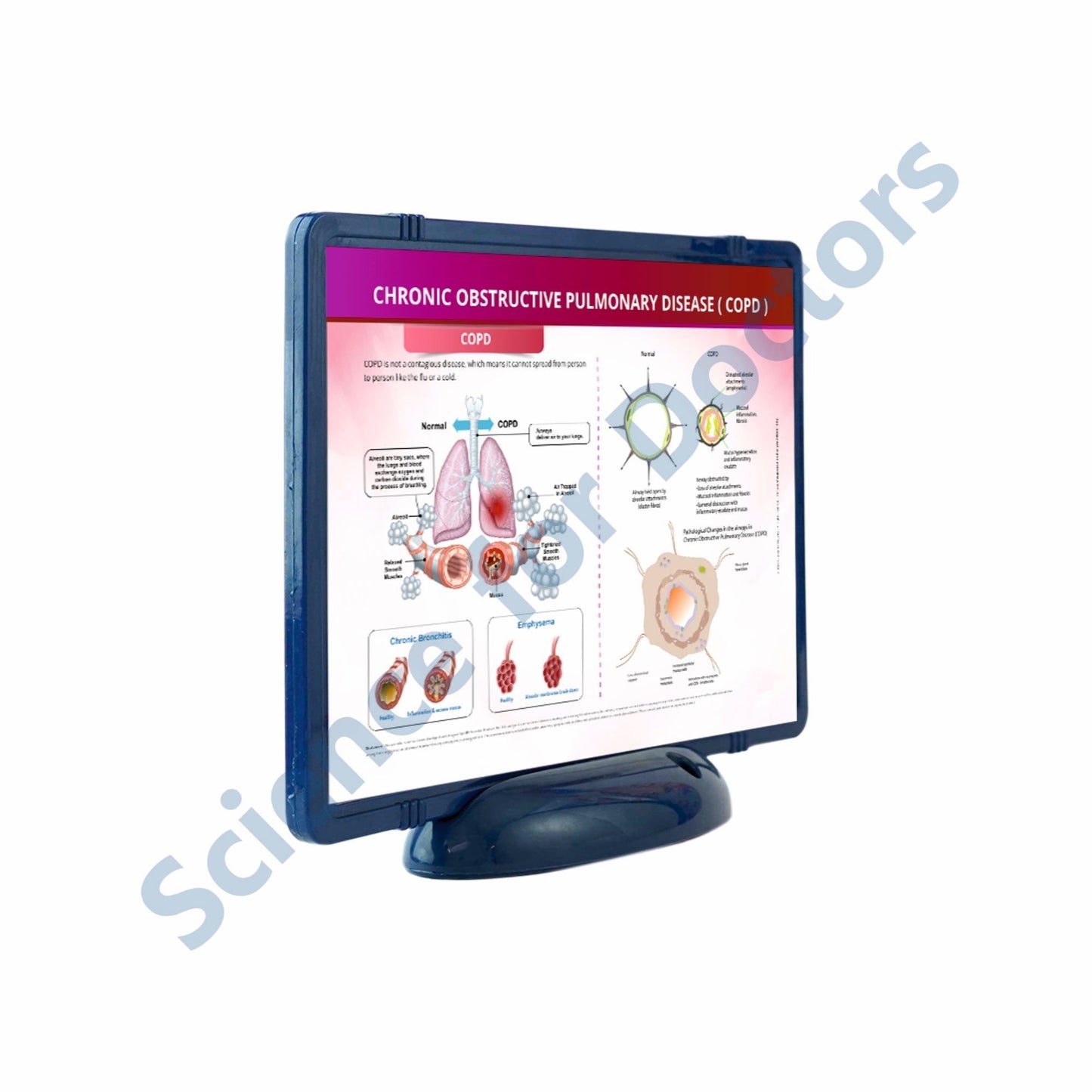 Chronic Obstructive Pulmonary Disease(COPD): The Frame Write and Wipe