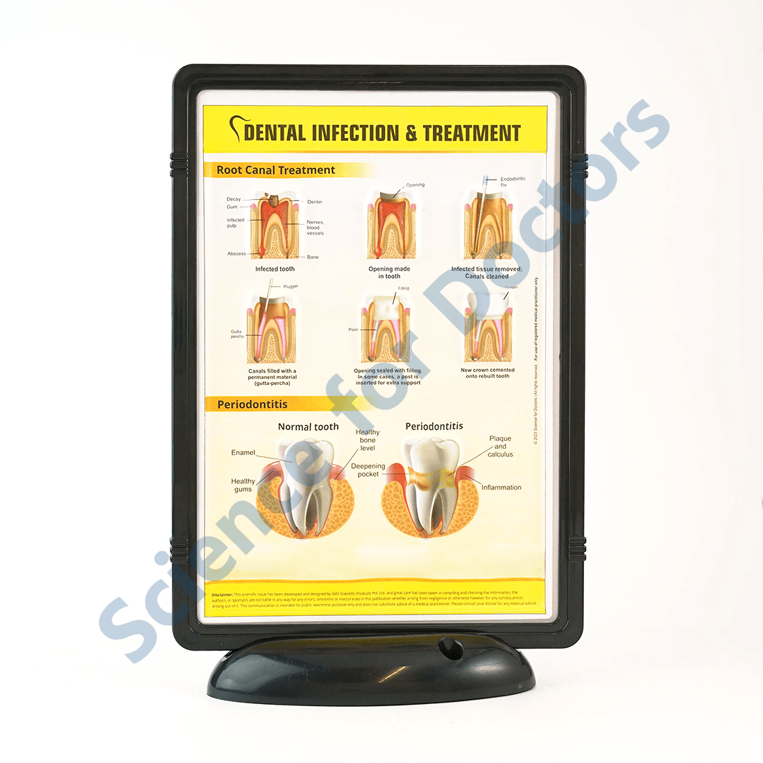 Dental Infection and Treatment: 3D Pop Up Frame* (MOQ 300)