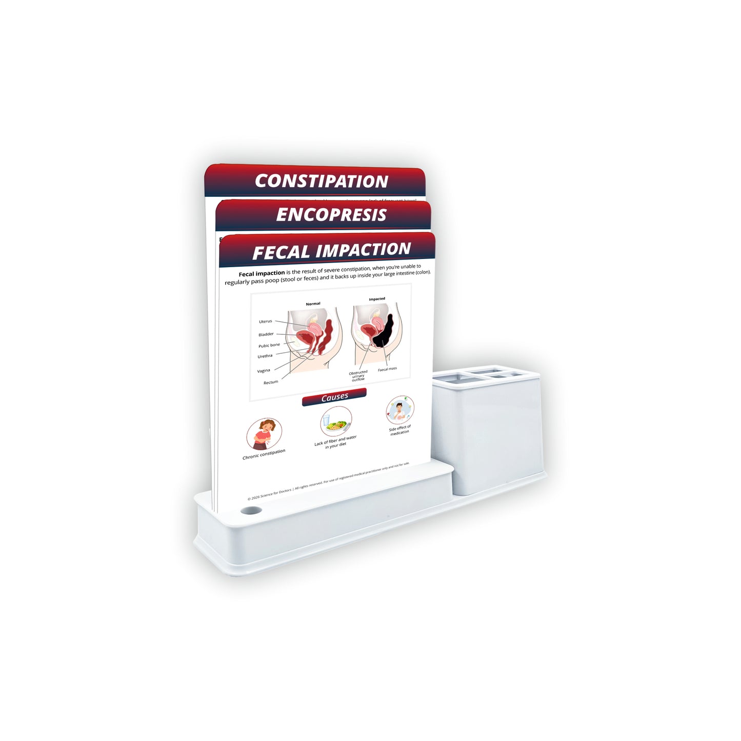 Smart - 3 Slides Write & Wipe With Stationary Stand - Fecal Impaction