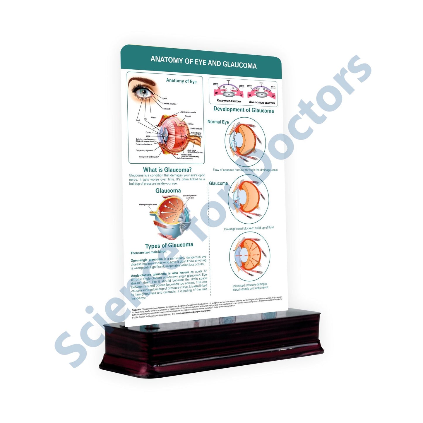 Anatomy of Eye and Glaucoma  - 1 Slide With Stand