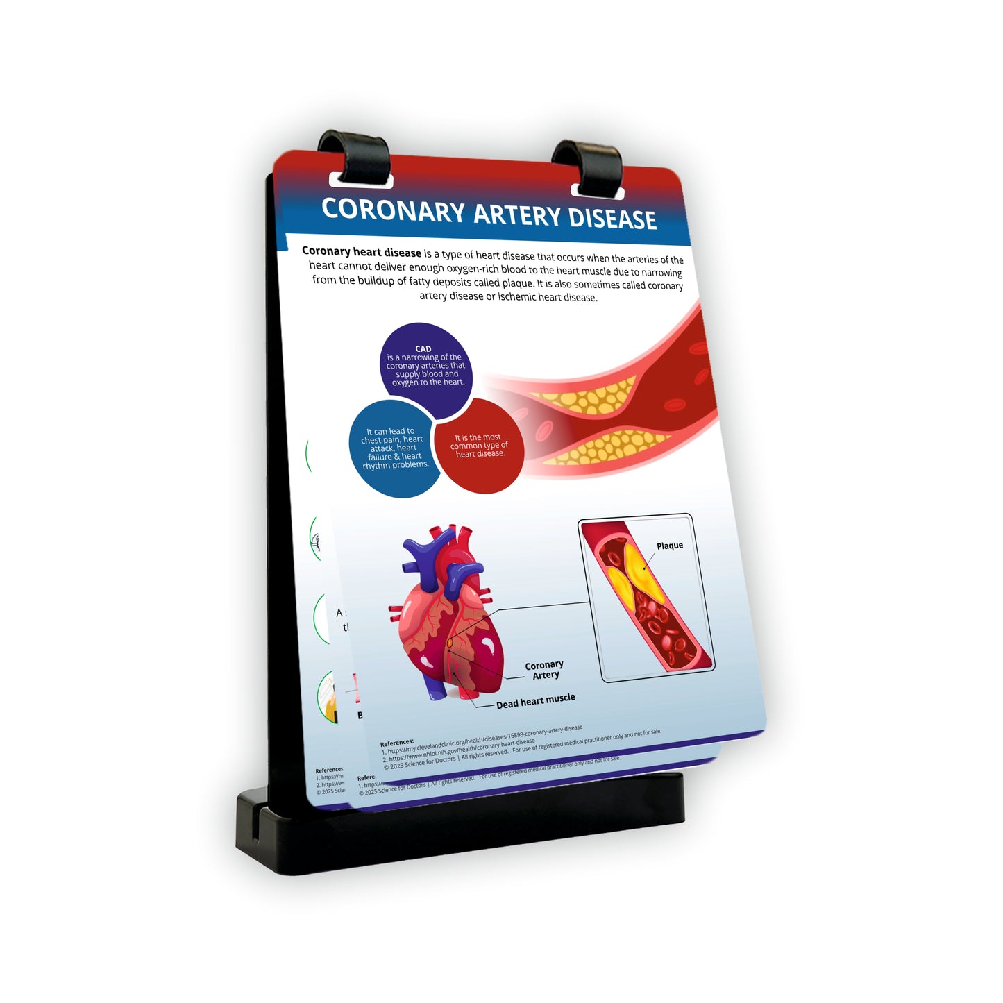 Coronary Artery Disease: A4 Flip Wipe