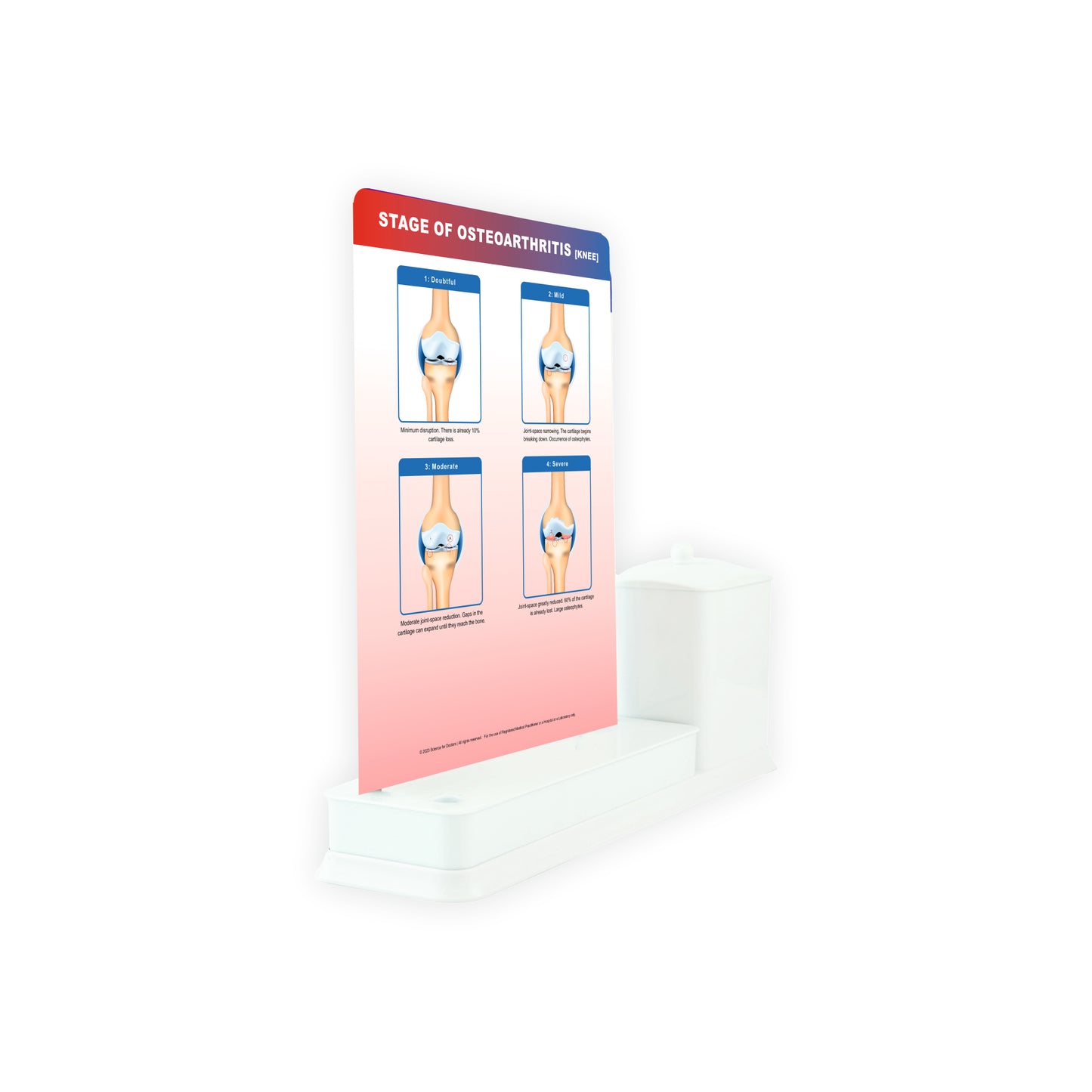 STAGE OF OSTEOARTHRITIS: 1 Slides Write & Wipe with Stationary Stand