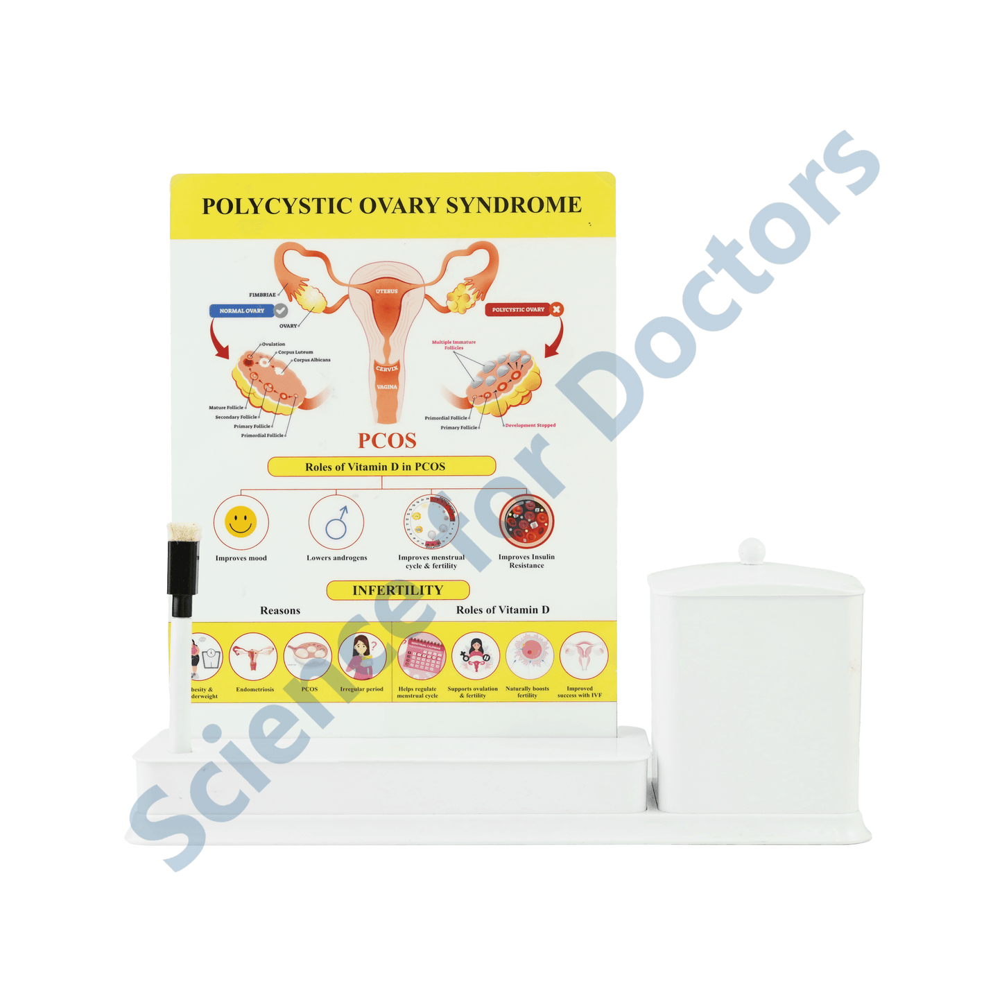 PCOS: 1 Slides Write & Wipe with Stationary Stand