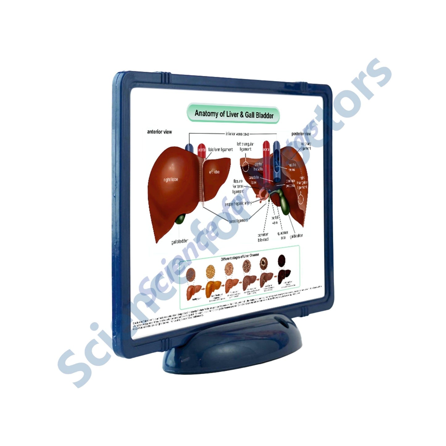 Anatomy of Liver & Gall Bladder: The Frame Write & Wipe