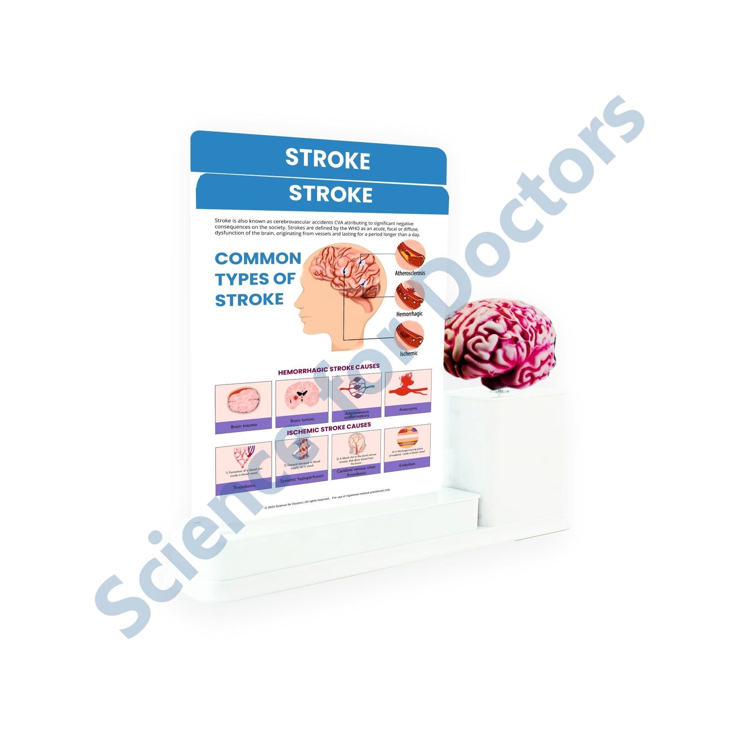 Stroke: 2 Slides Write and Wipe with Anatomical Model On Stand