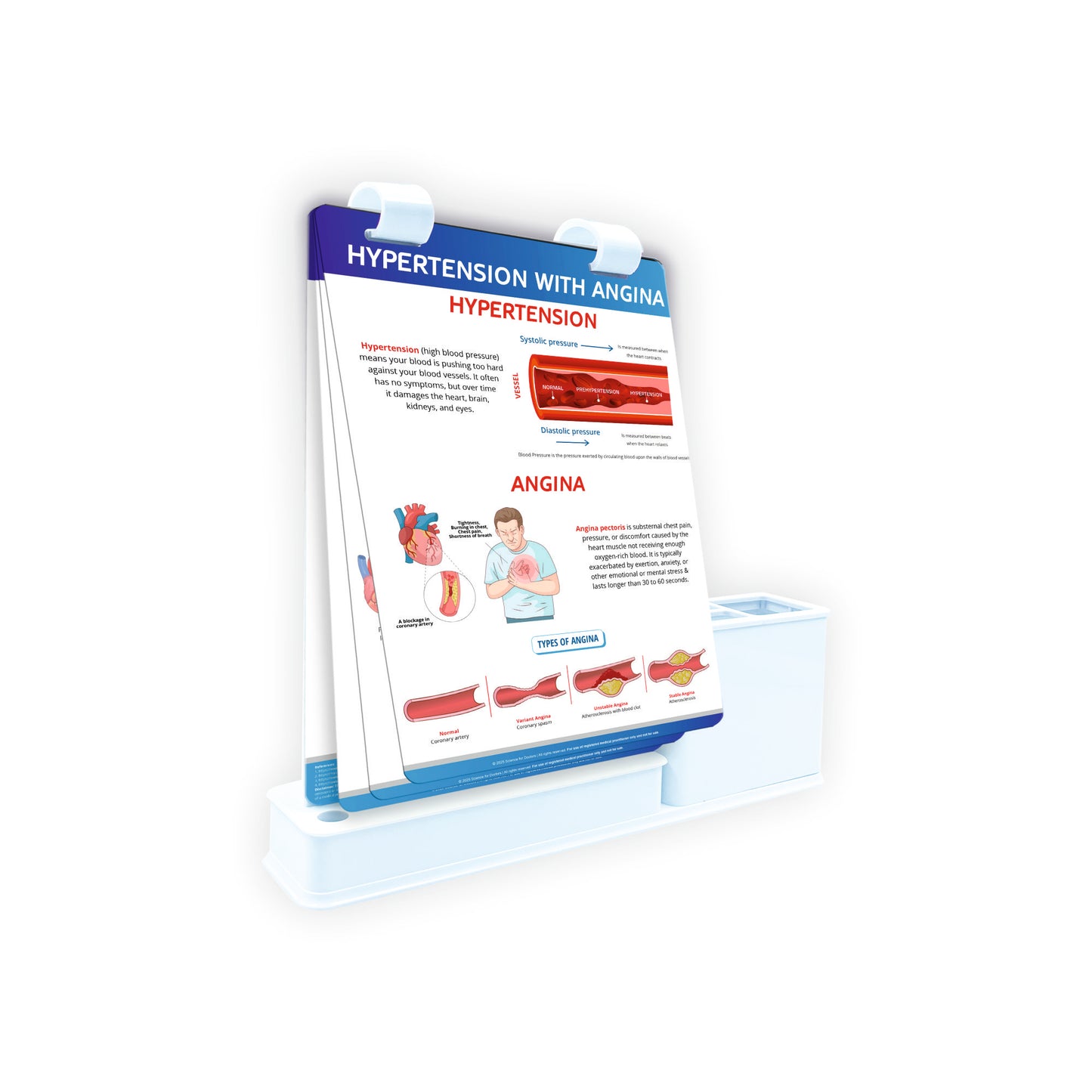 Smart - A5 Flip wipe With Stationery Stand  -  HYPERTENSION WITH ANGINA