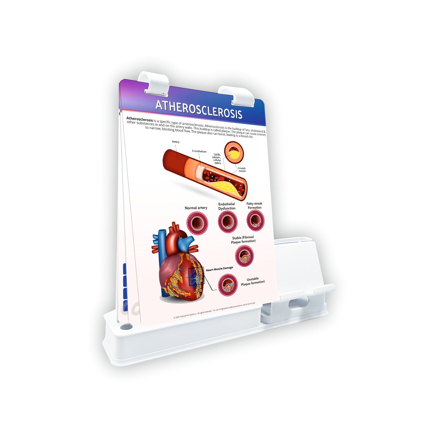 Smart -A5 Flip wipe With Mobile and Chit Pad Stand  - Atherosclerosis