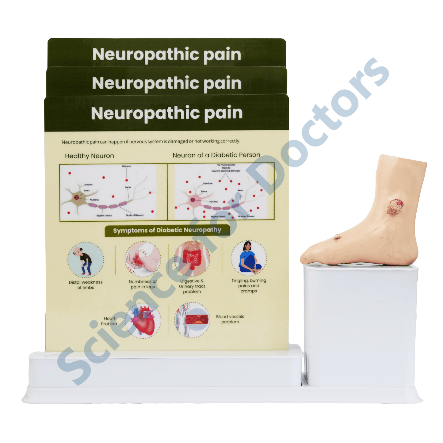 Neuropathic Pain : 3 Slide Write and Wipe with Anatomical Model on Stand