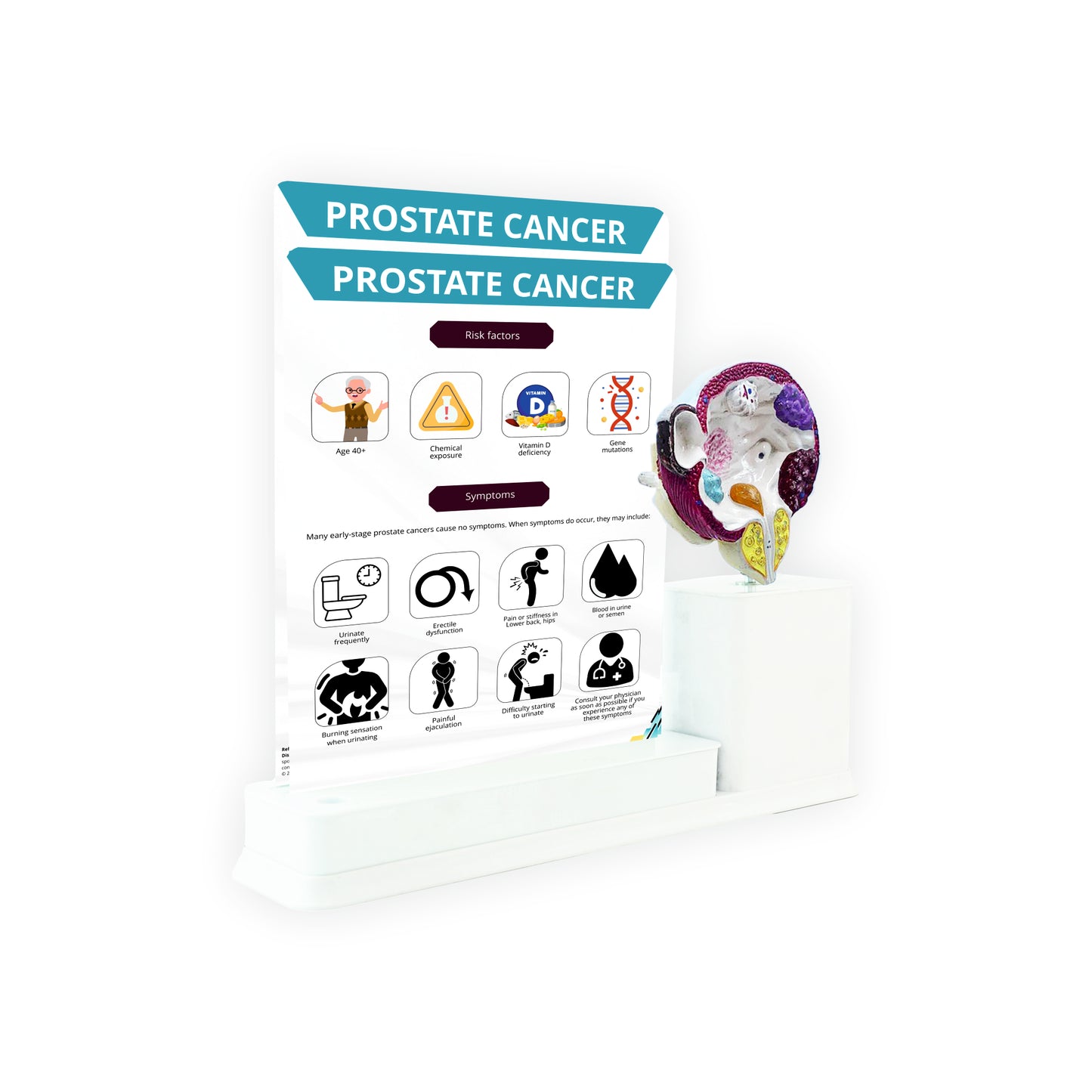 Prostate Cancer_1: 2 Slides Write and Wipe with Model On Stand