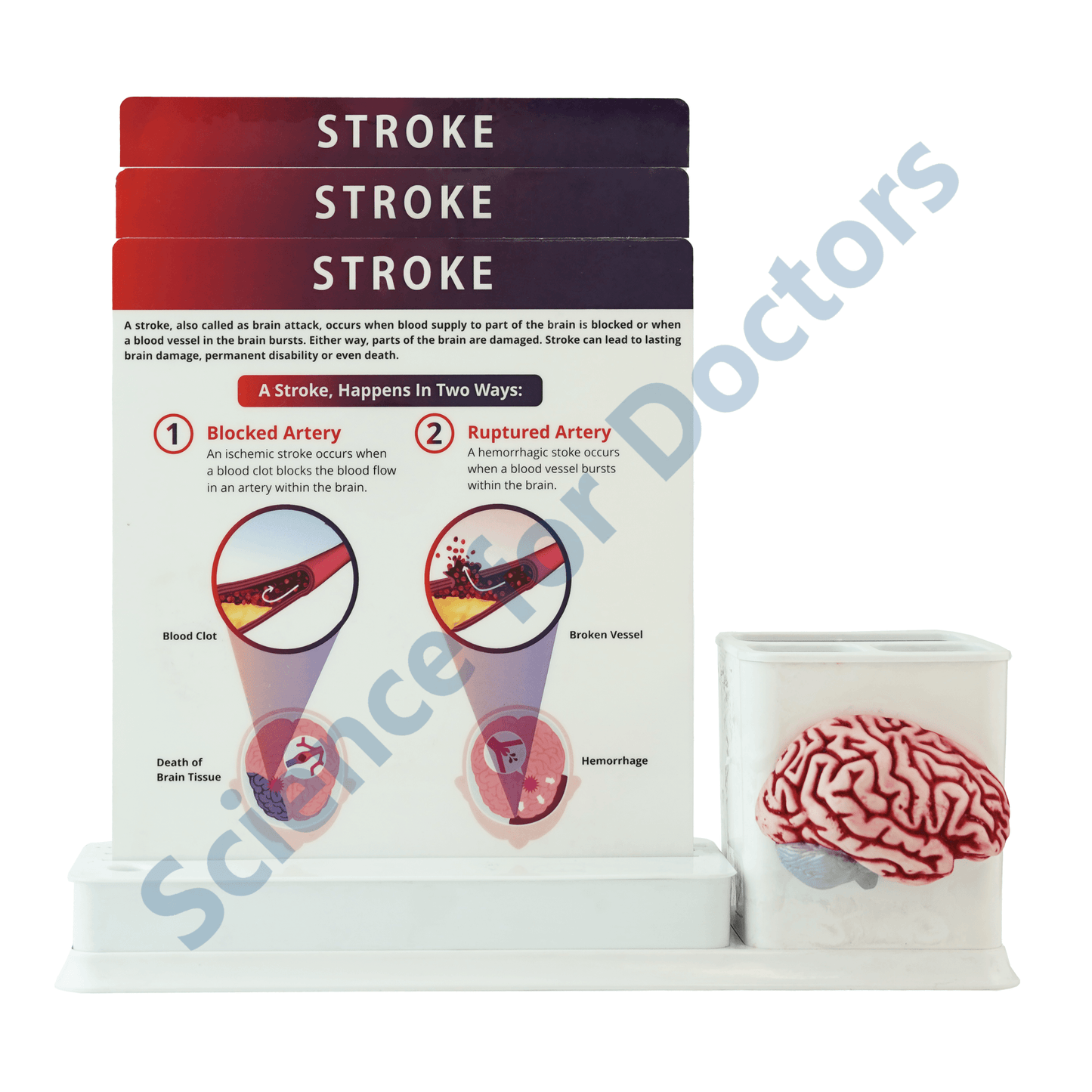 Stroke : 1 Slide Write and wipe with anatomical model on stationery stand