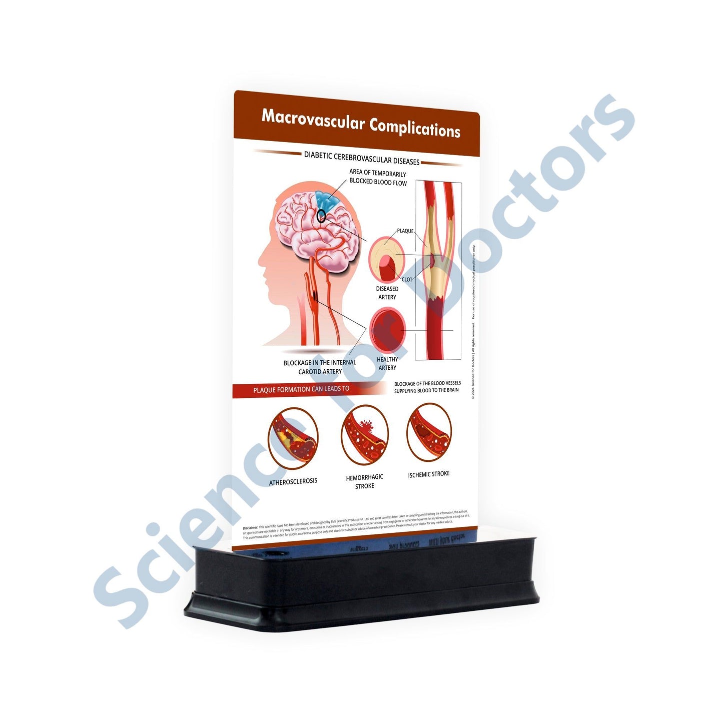 Macrovascular Complications: 1 Slide on stand