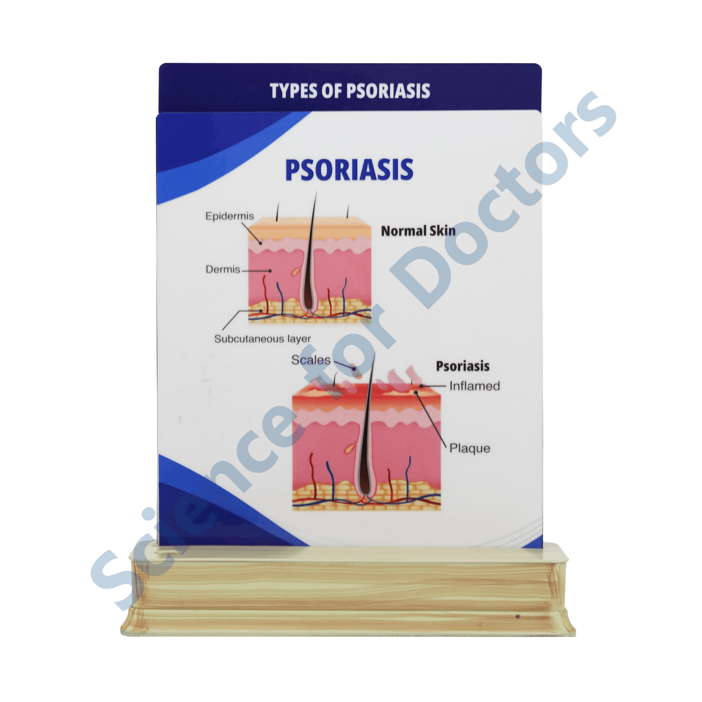 Psoriasis: 2 Slide on stand