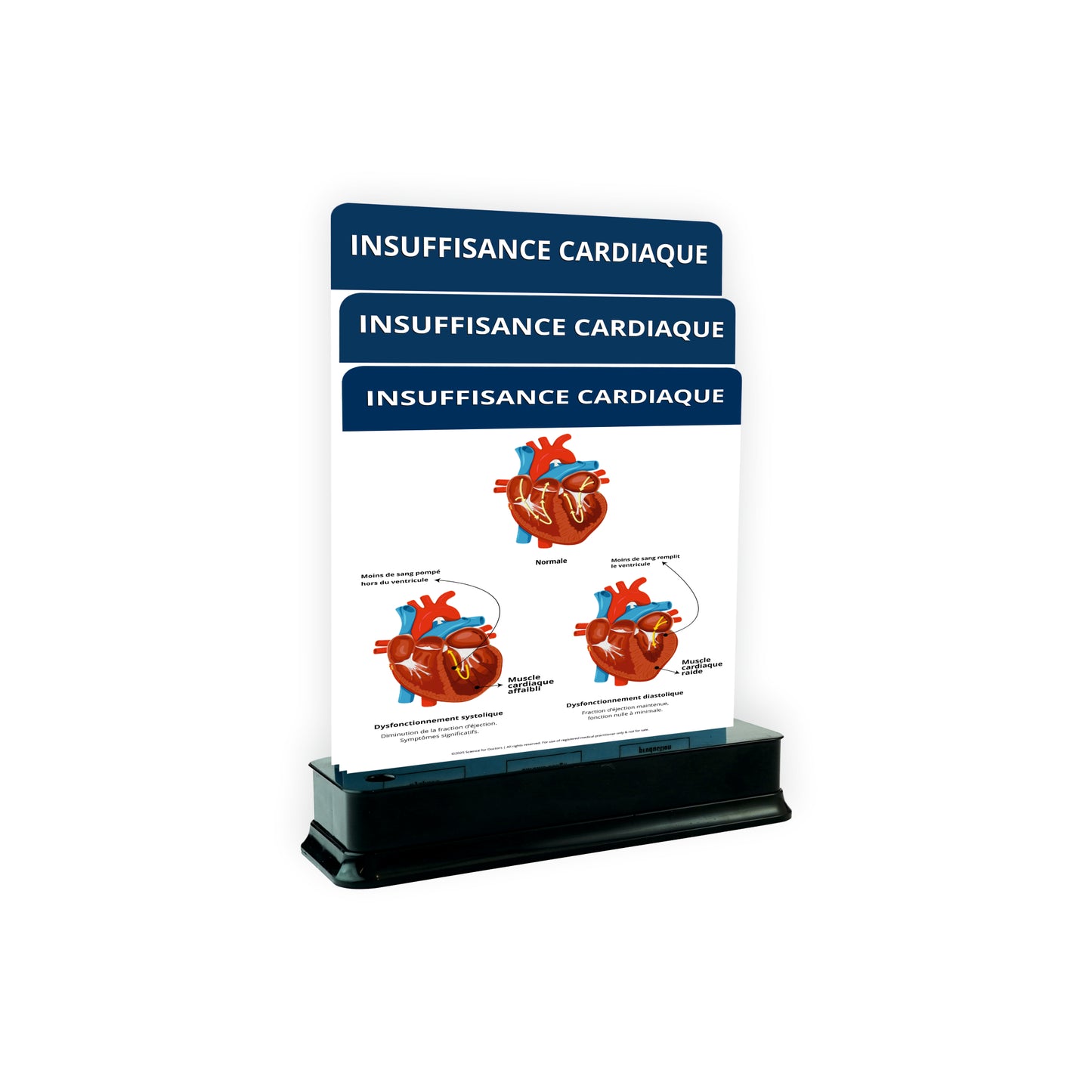 Insuffisance Cardiaque: 3 Slides on Stand