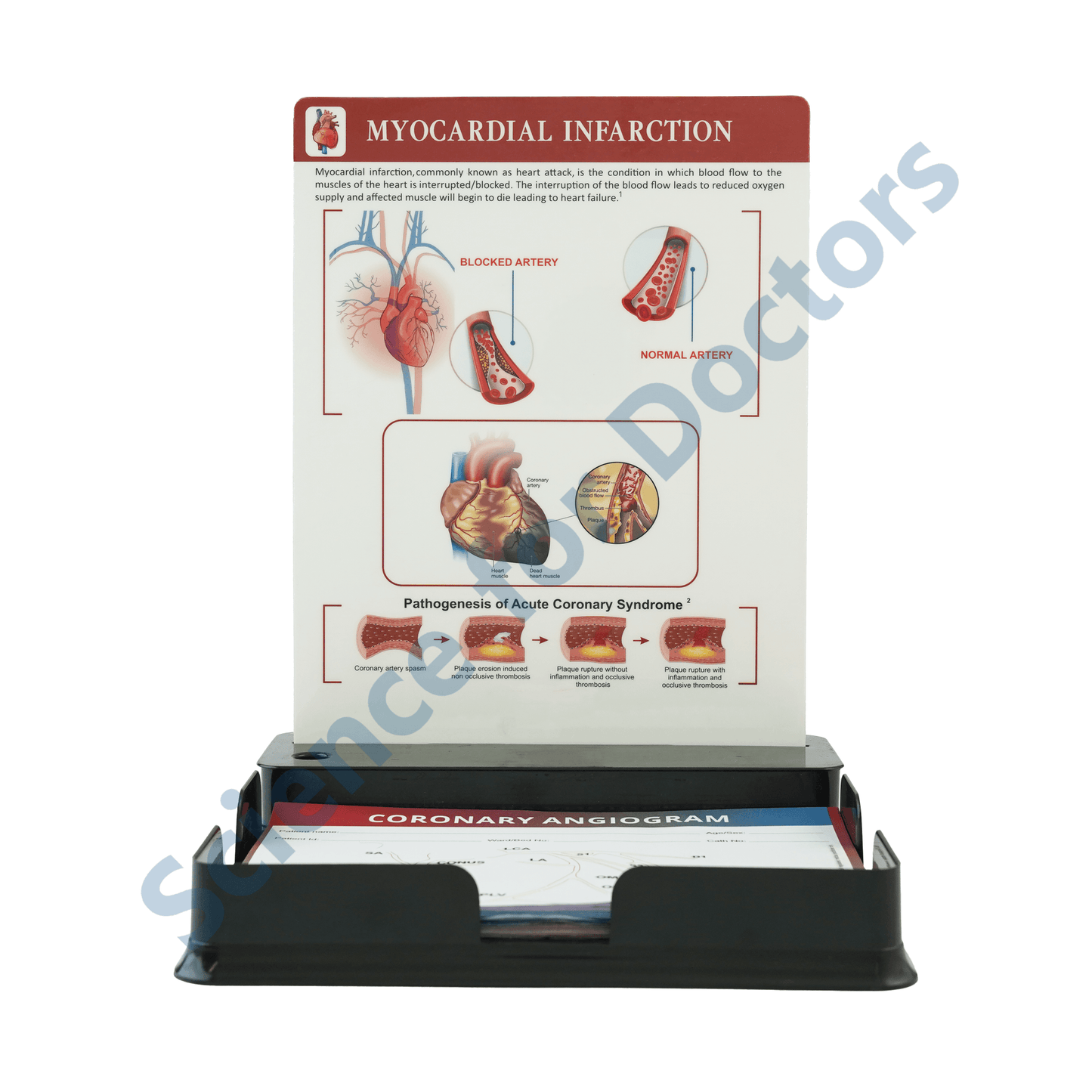 Myocardial infarction: One slide with Tray