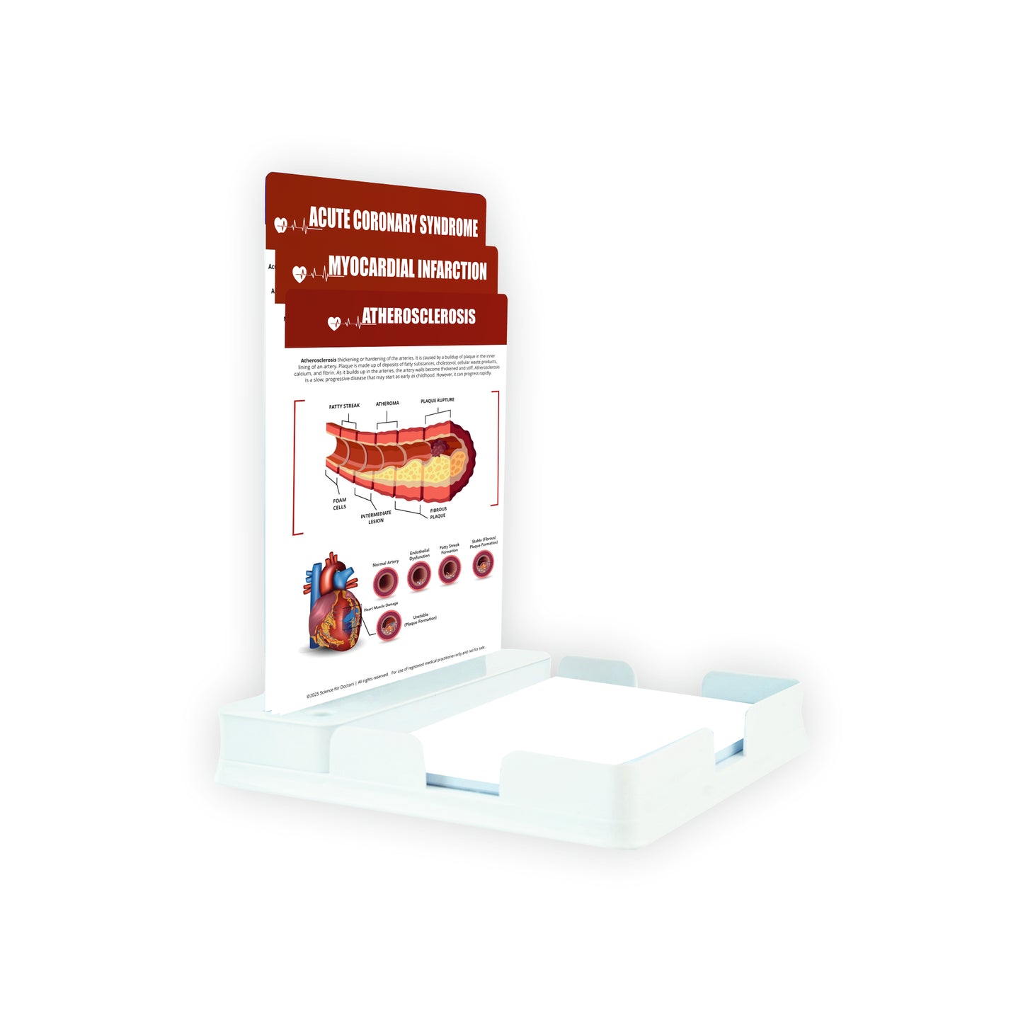 Atherosclerosis: 3 Slides With Tray