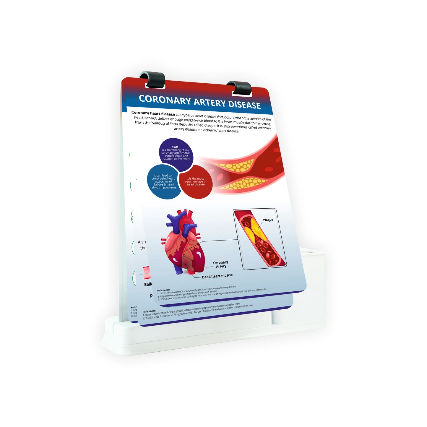Coronary Artery Disease: A4 Flip wipe With Stationery Stand