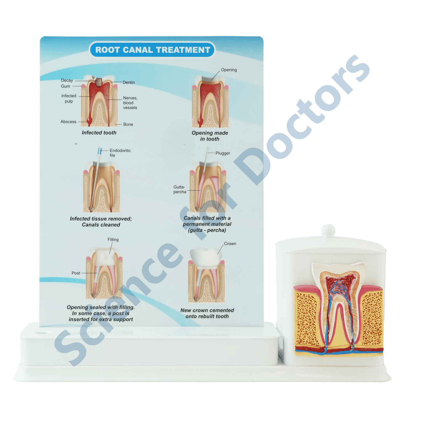 Root Canal Treatment : 1 Slide Write and wipe with anatomical model on stationery stand