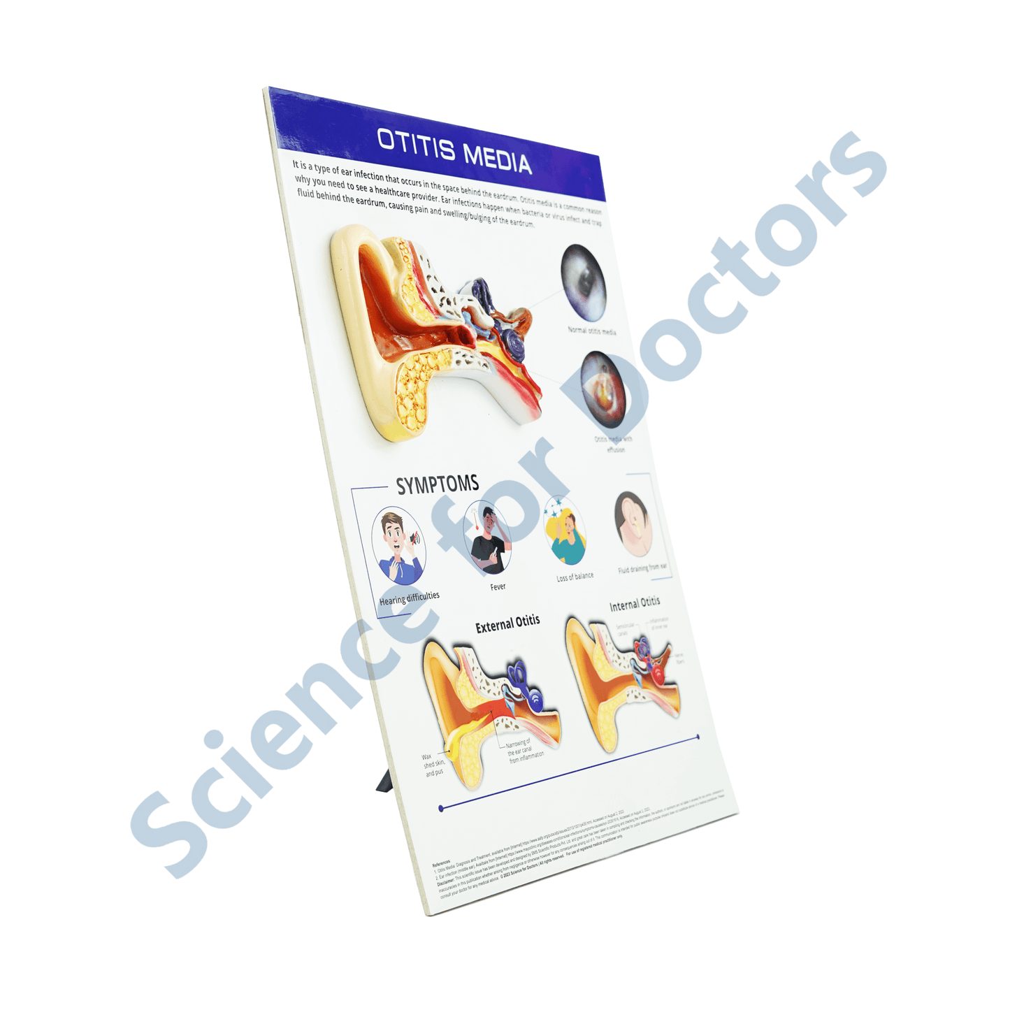 Otitis Media: 3d therapy Board