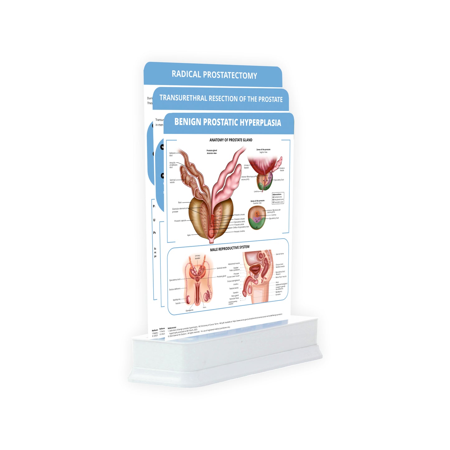 Benign Prostatic Hyperplasia : 3 Slides on Stand